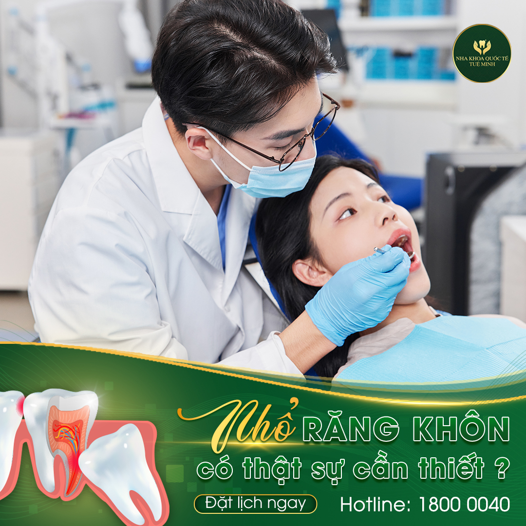Nhổ Răng Khôn: Giải Pháp Tận Tâm Tại Nha Khoa Tuệ Minh