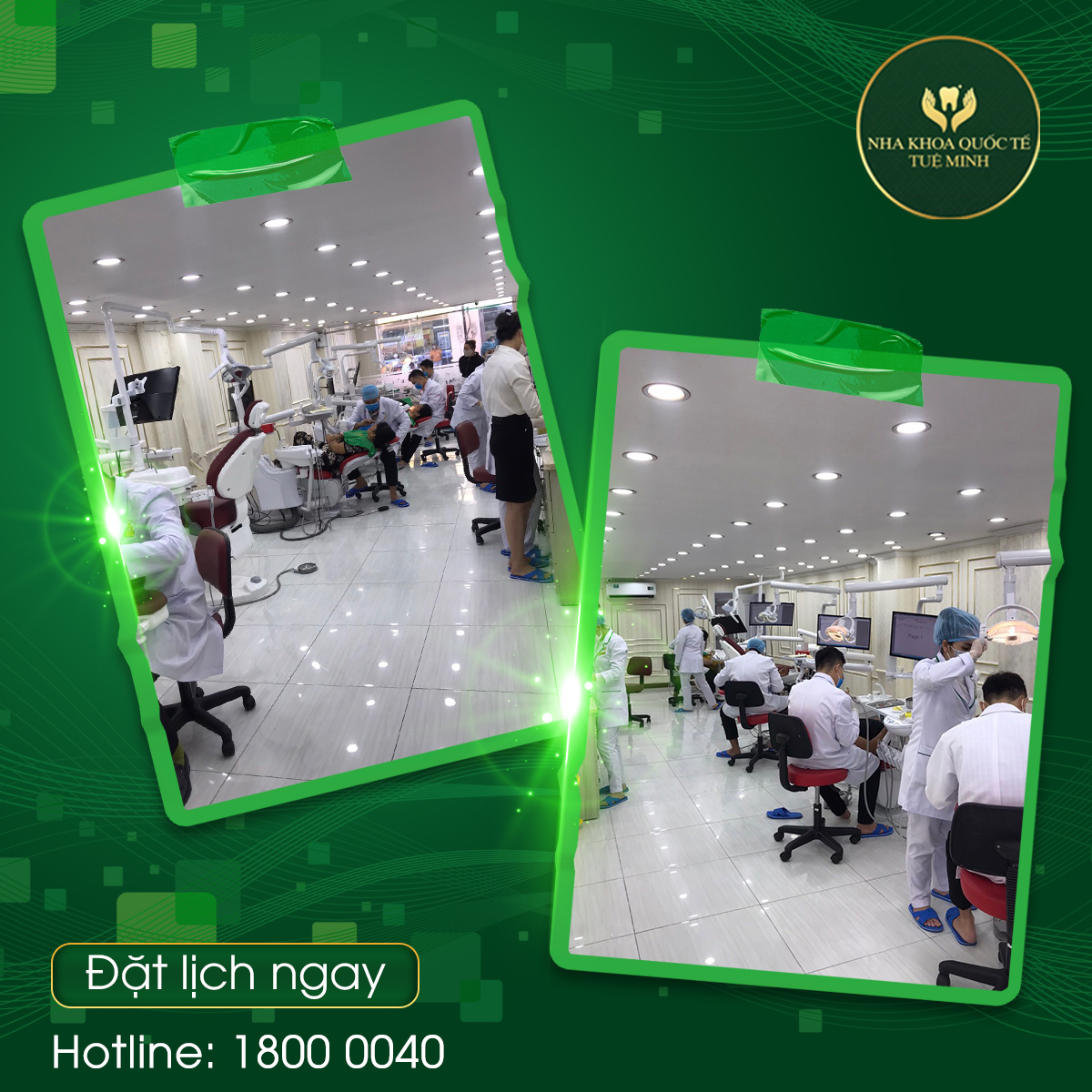 Đặt lịch ngay ! Nha khoa Quốc Tế Tuệ Minh hân hạnh phục vụ quý khách