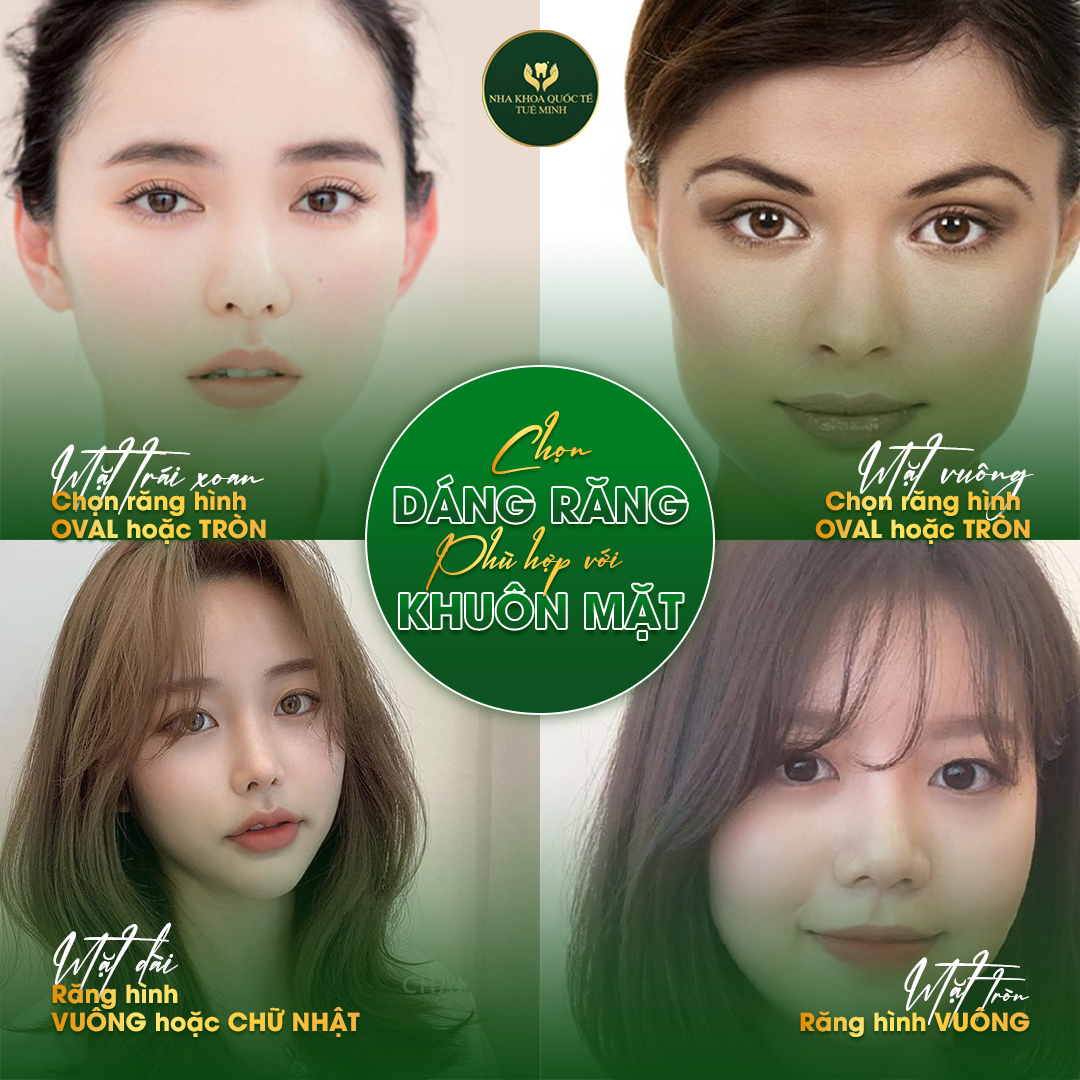 Chọn Dáng Răng Sứ Phù Hợp với Gương Mặt tại Nha Khoa Tuệ Minh