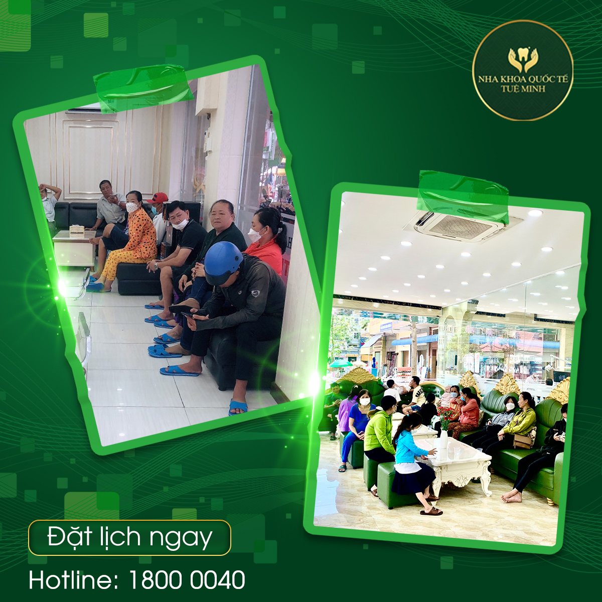 Tại Sao Răng Sau Khi Chữa Tủy Dễ Gãy Hơn và Giải Pháp Hiệu Quả Tại Nha Khoa Quốc Tế Tuệ Minh