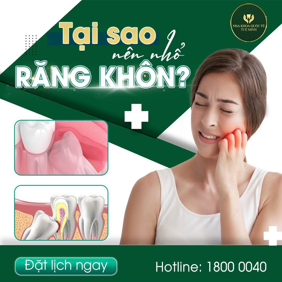 TẠI SAO NÊN NHỔ RĂNG KHÔN?