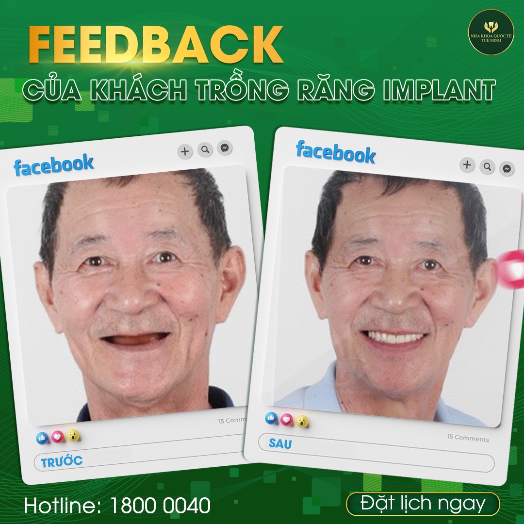 MẤT RĂNG Ở NGƯỜI GIÀ NGUY HIỂM NHƯ THẾ NÀO 