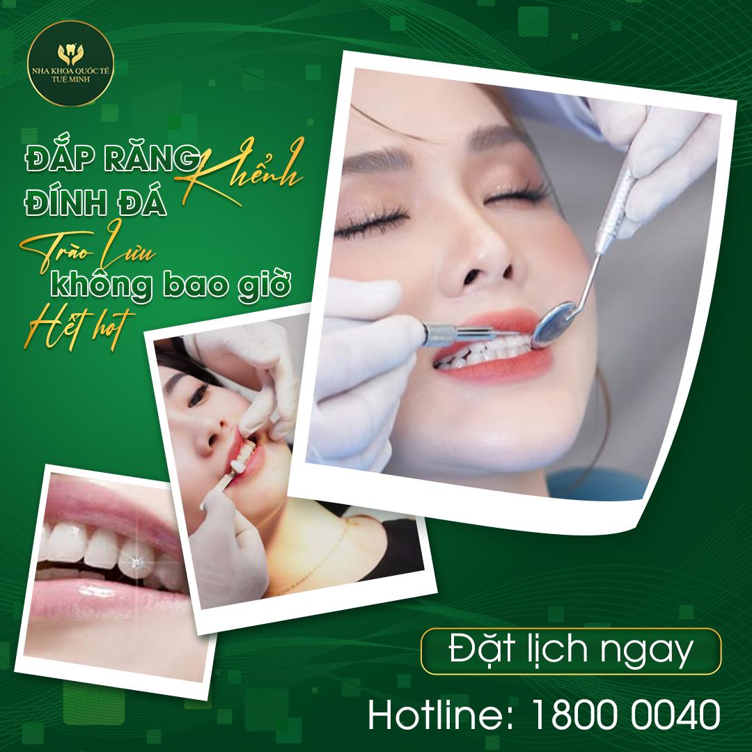 Đính đá – Tạo Điểm Nhấn Tinh Tế Cho Nụ Cười