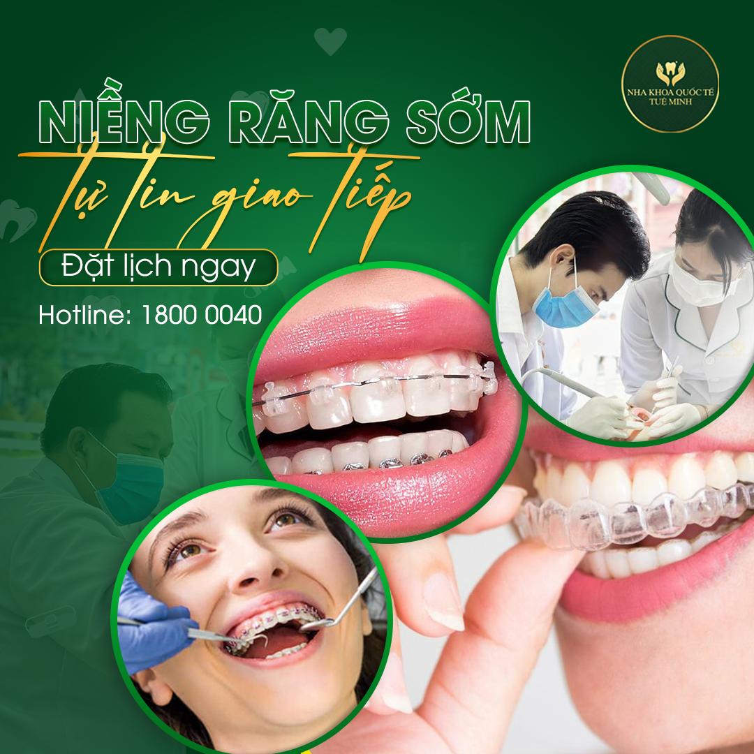 Niềng răng – Cải Thiện Hình Dáng Răng, Điều Chỉnh Hàm Hơn