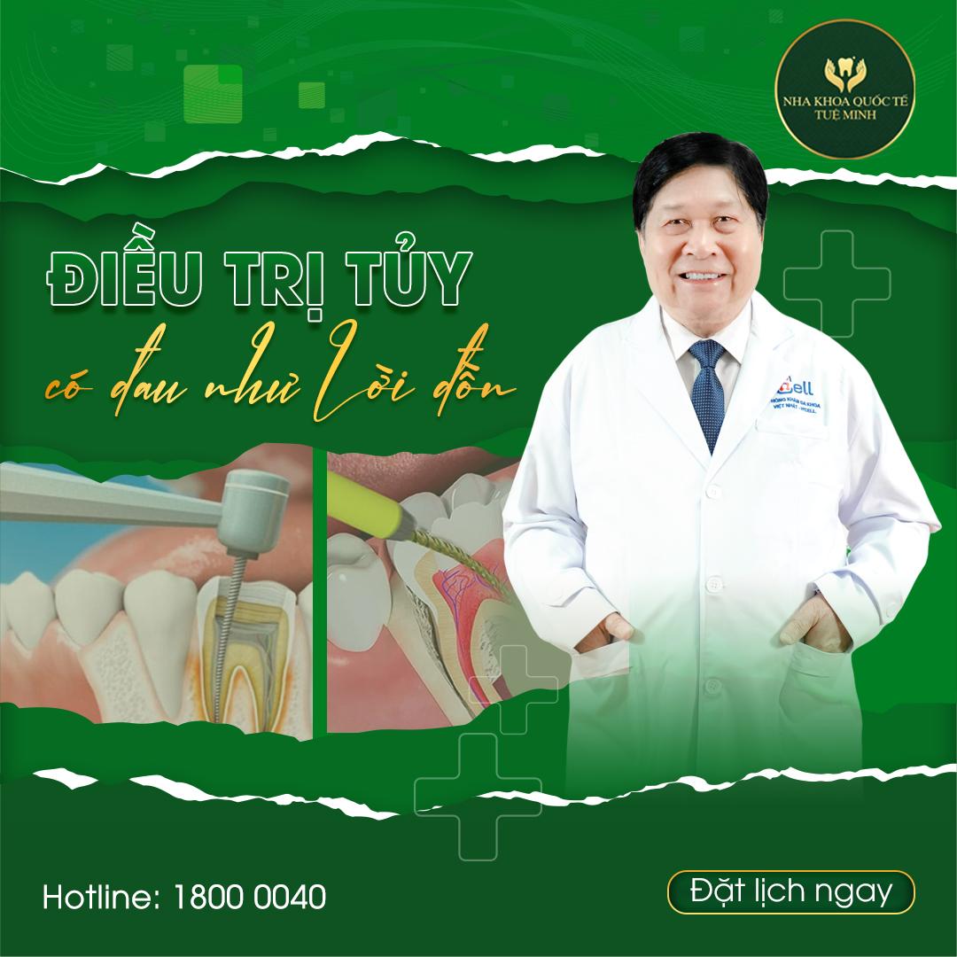 Điều Trị Tủy Răng: Giải Pháp Nhanh Chóng và Hiệu Quả Tại Nha Khoa Quốc Tế TUỆ MINH