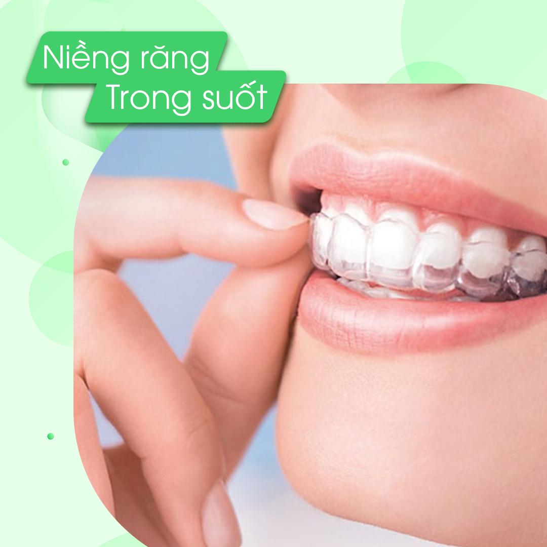 Niềng Răng Trong Suốt – Niềng Như Không Niềng