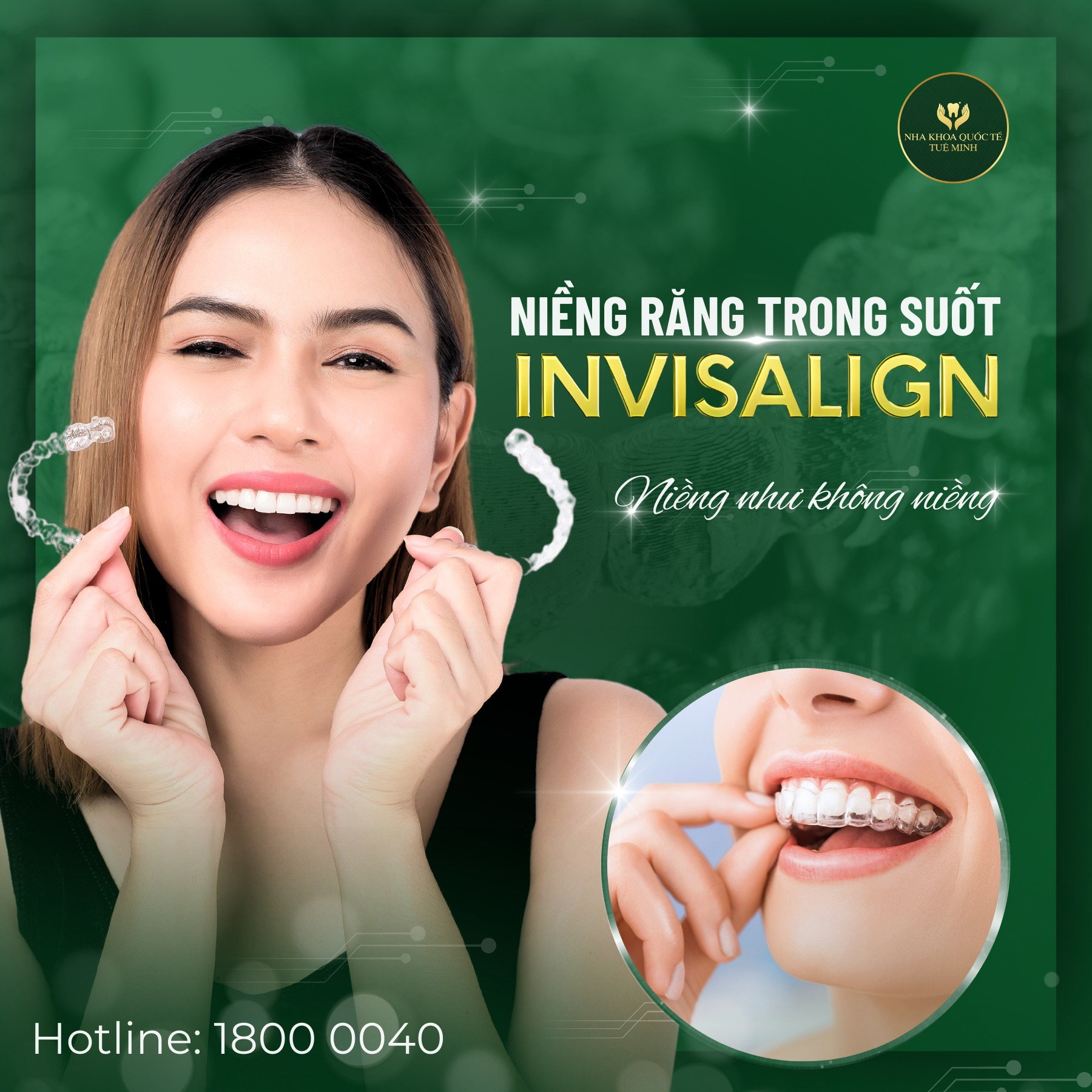 Niêng Răng Thẩm Mỹ – Lấy Lại Nụ Cười Tự Tin!