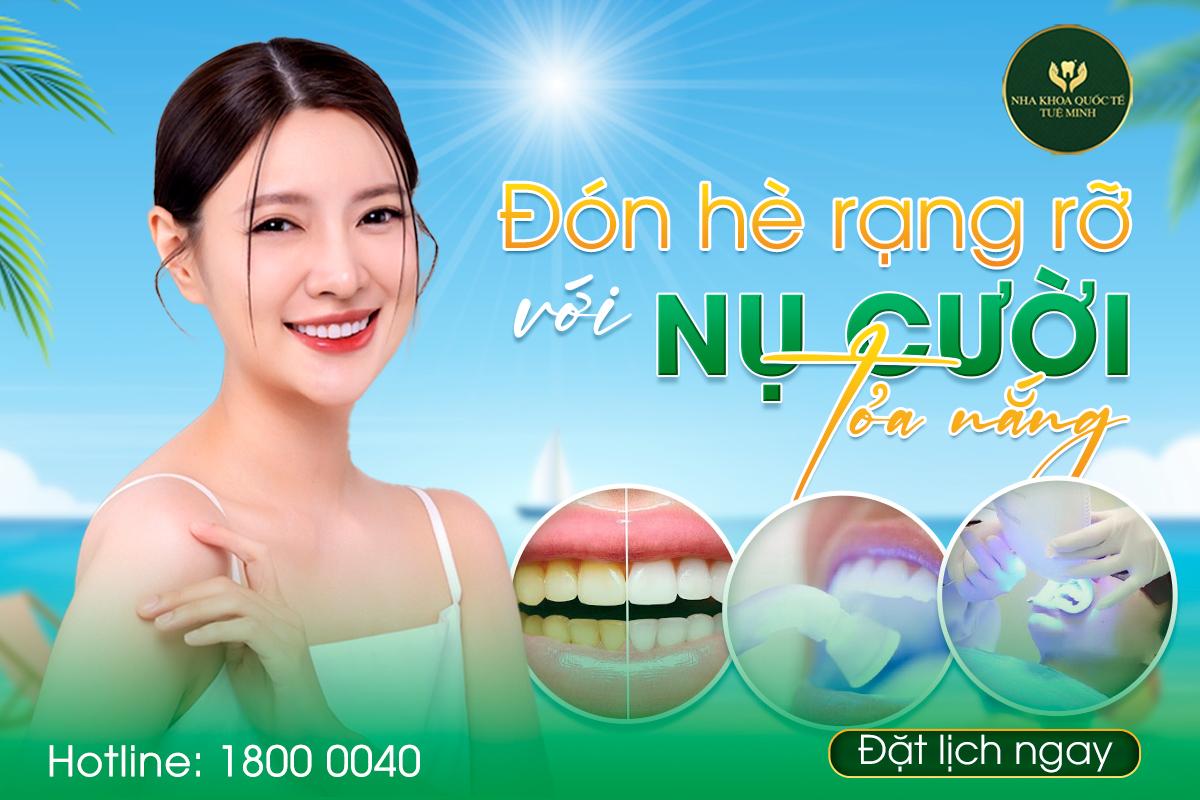 Tẩy Trắng Răng – Khám Phá Bí Quyết Cho Nụ Cười Sáng Bóng