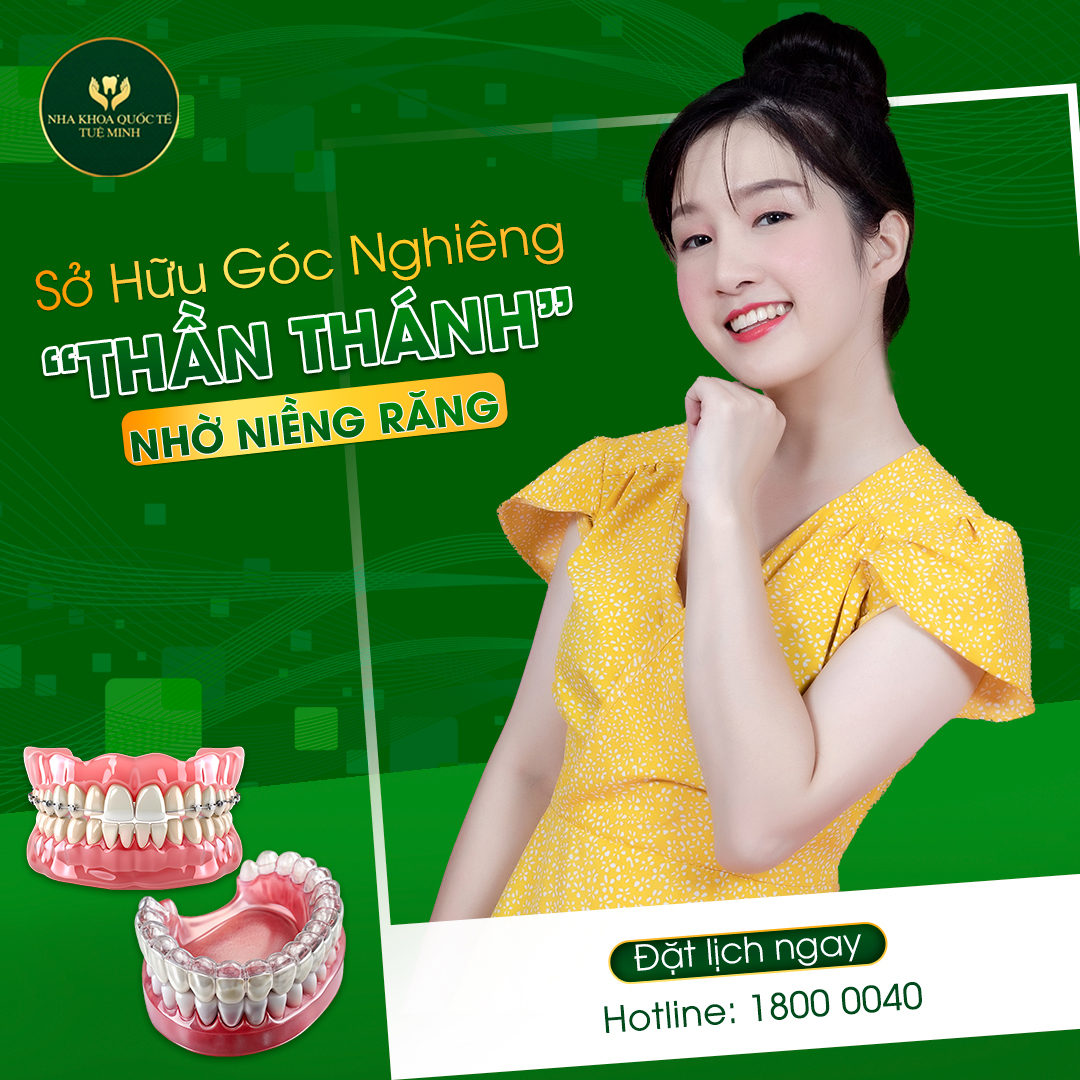 Sở Hữu Góc Nghiêng THẦN THÁNH Nhờ Niềng Răng tại Nha Khoa Quốc Tế Tuệ Minh