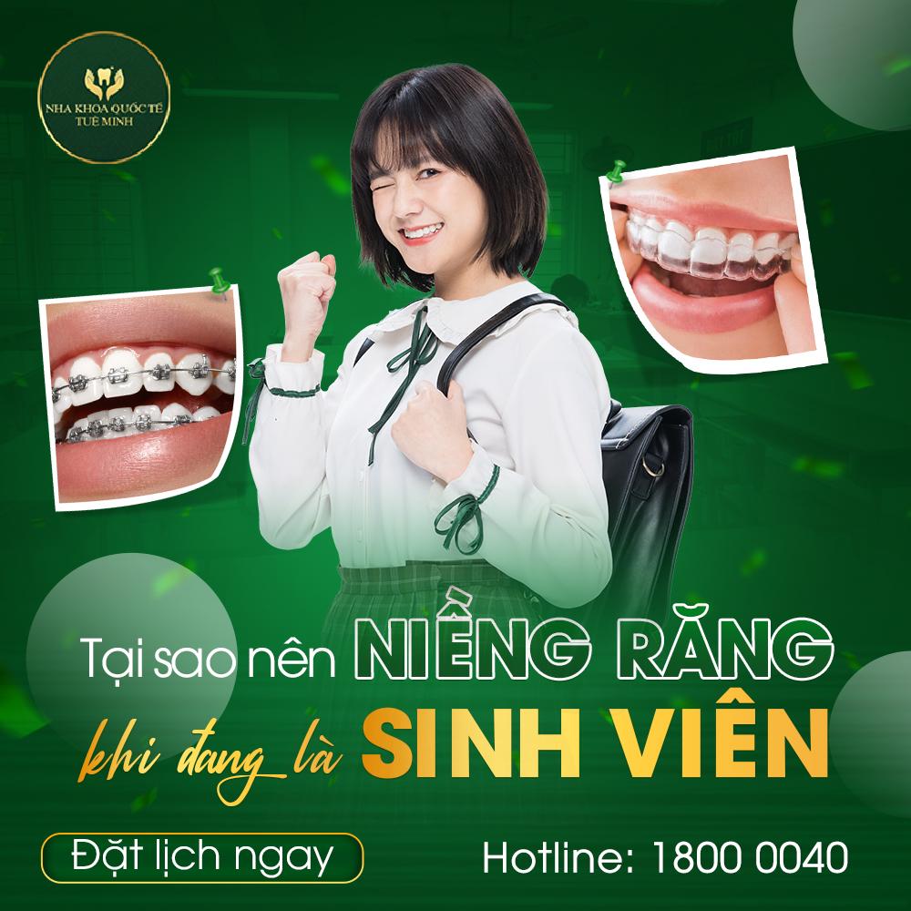 Tại Sao Nên Niềng Răng Khi Đang Là Sinh Viên?