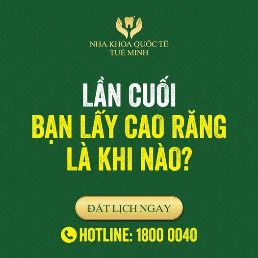 Bao Lâu Nên Lấy Cao Răng 1 Lần? Nha Khoa Quốc Tế Tuệ Minh Địa Chỉ Lấy Cao Răng Uy Tín!