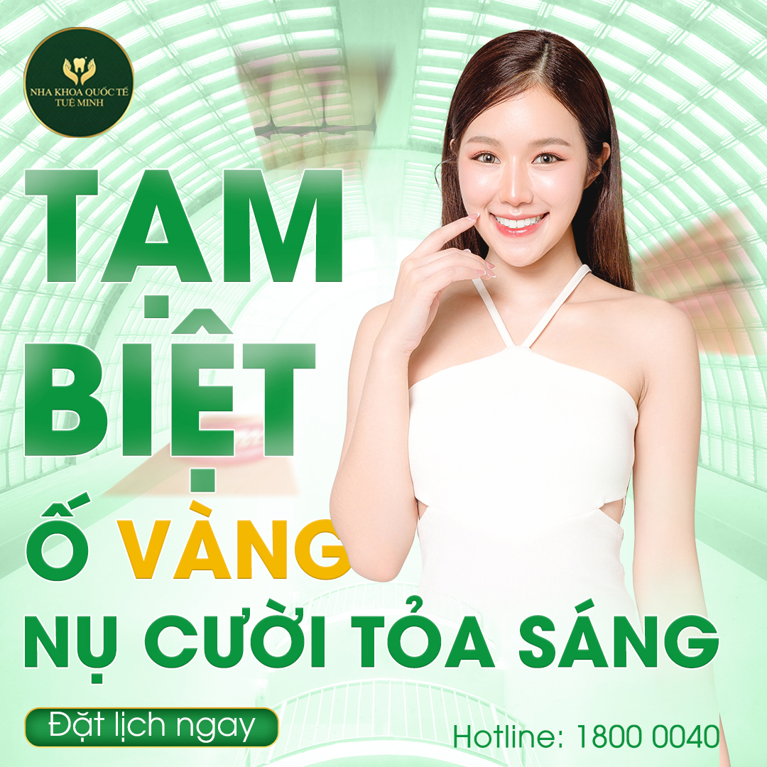 TẠM BIỆT Ố VÀNG, NỤ CƯỜI TỎA SÁNG! 