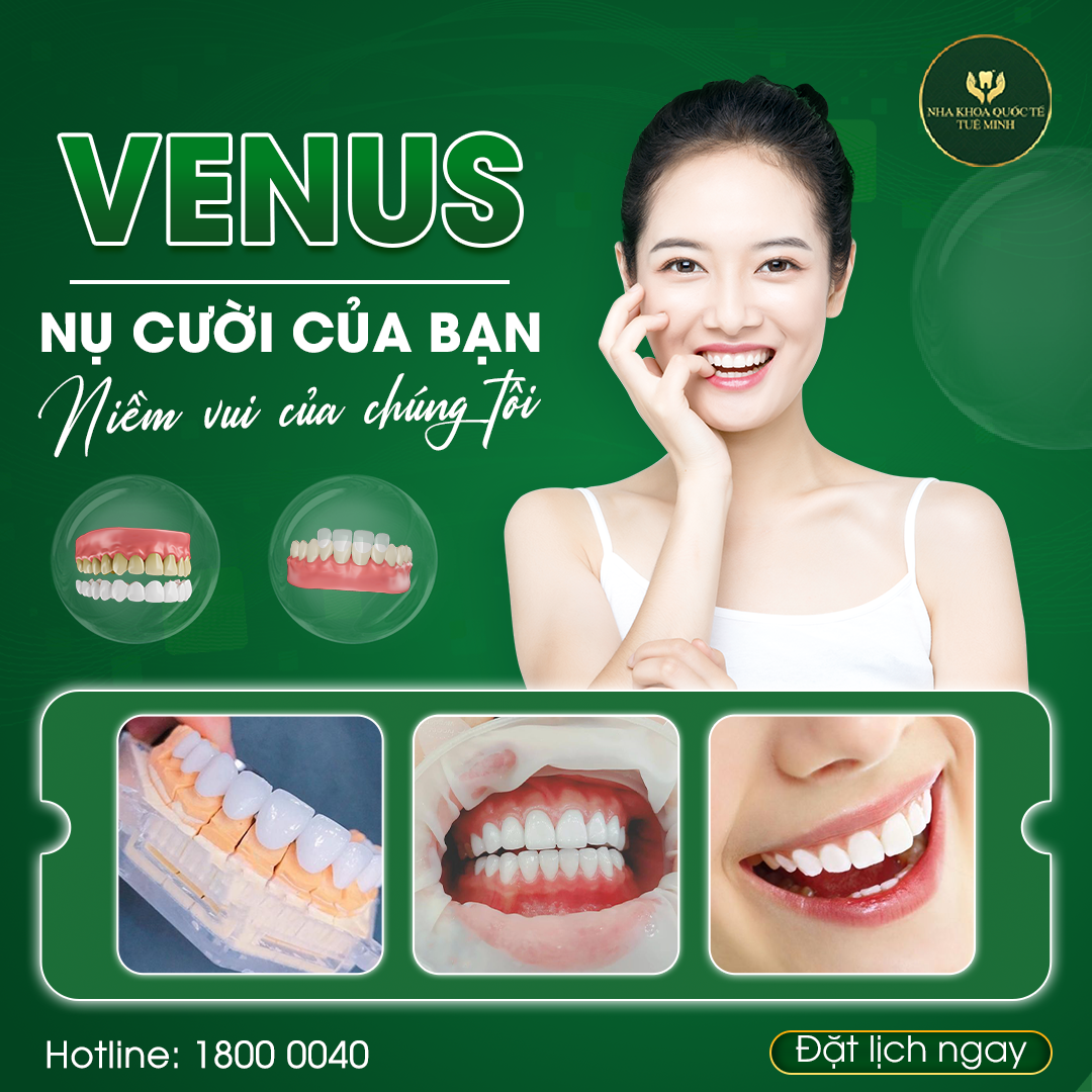 Răng Sứ Venus – Sự Lựa Chọn Hoàn Hảo Cho Nụ Cười Rạng Rỡ!