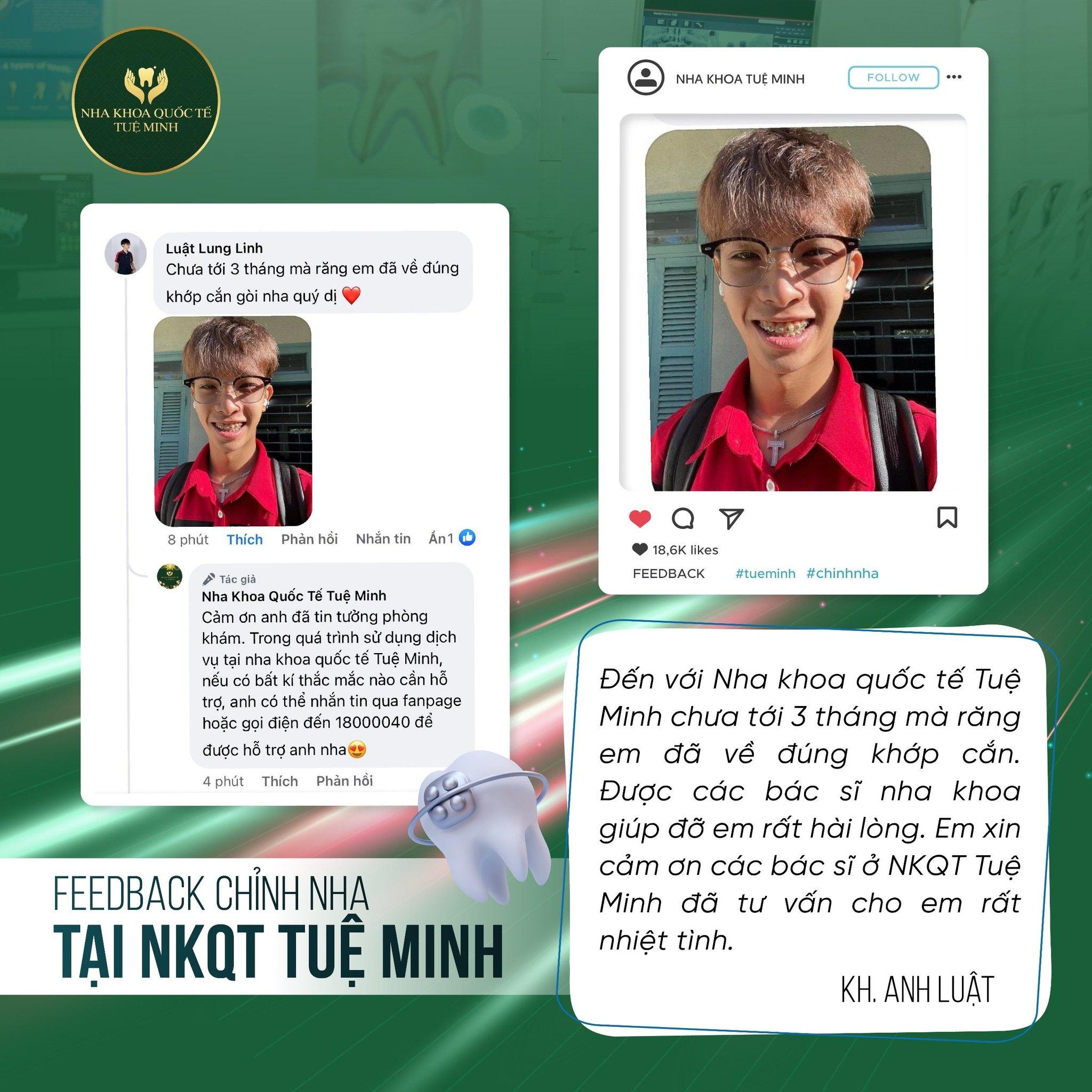 Niềng Răng Thay Đổi Cuộc Đời Bạn!