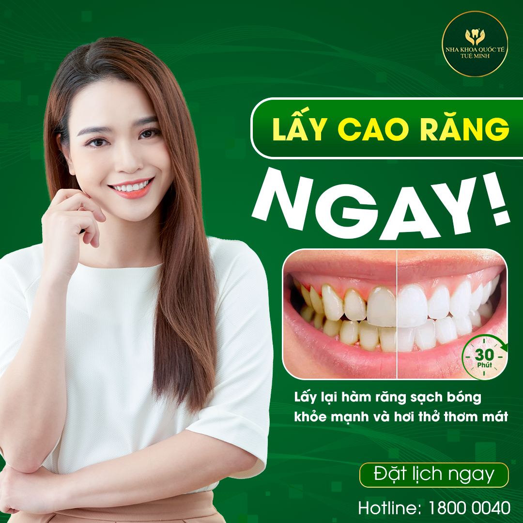 Chỉ 30 phút lấy cao răng tại Nha Khoa Quốc Tế Tuệ Minh!