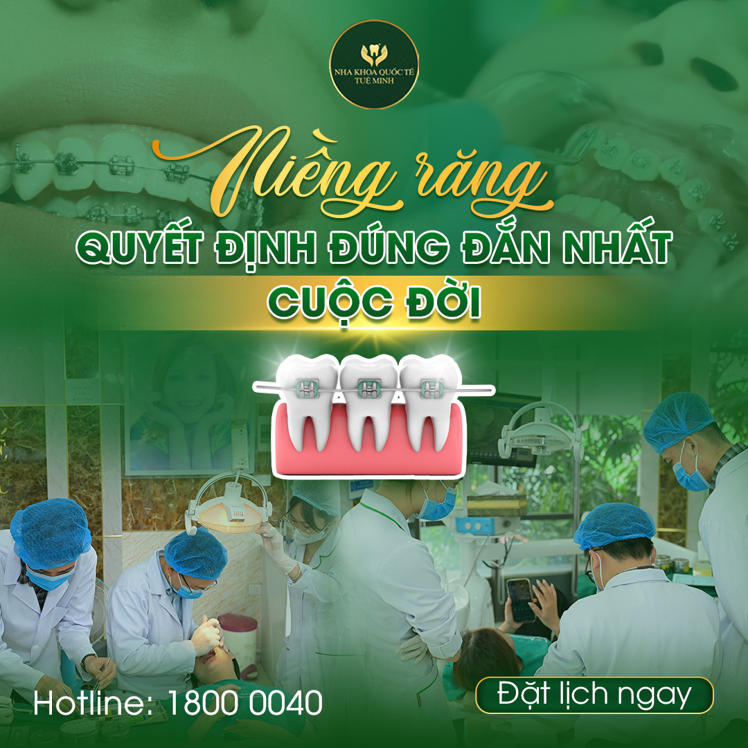 Khi Nào Nên Niềng Răng Cho Người Lớn?