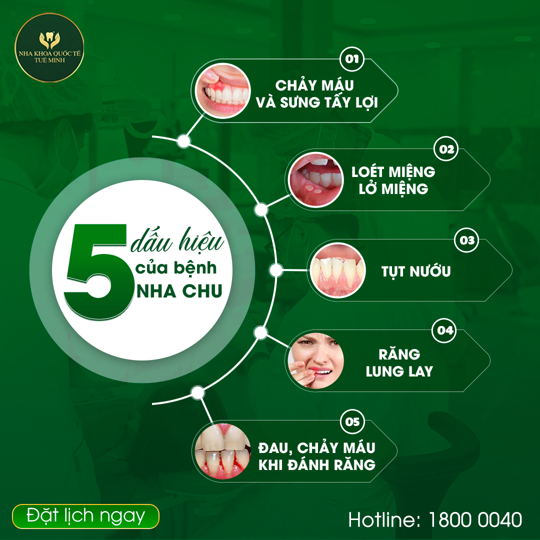 SOS! Những Dấu Hiệu Bạn Cần Biết Để Phát Hiện Sớm Bệnh Nha Chu!