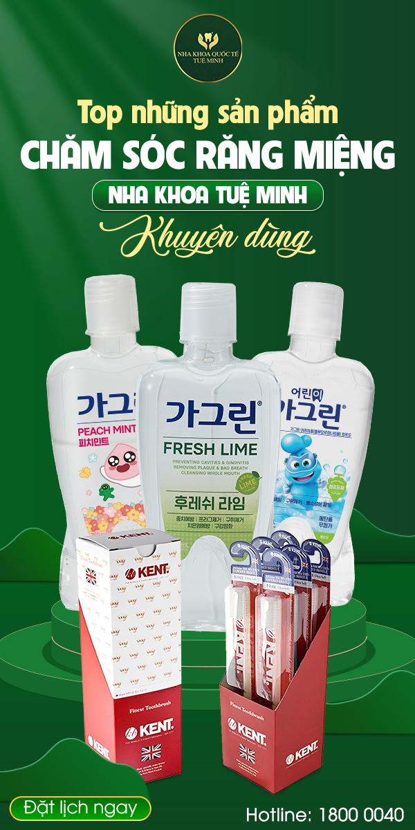 TOP NHỮNG SẢN PHẨM CHĂM SÓC RĂNG MIỆNG HÀNG ĐẦU ĐƯỢC NHA KHOA QUỐC TẾ TUỆ MINH KHUYÊN DÙNG