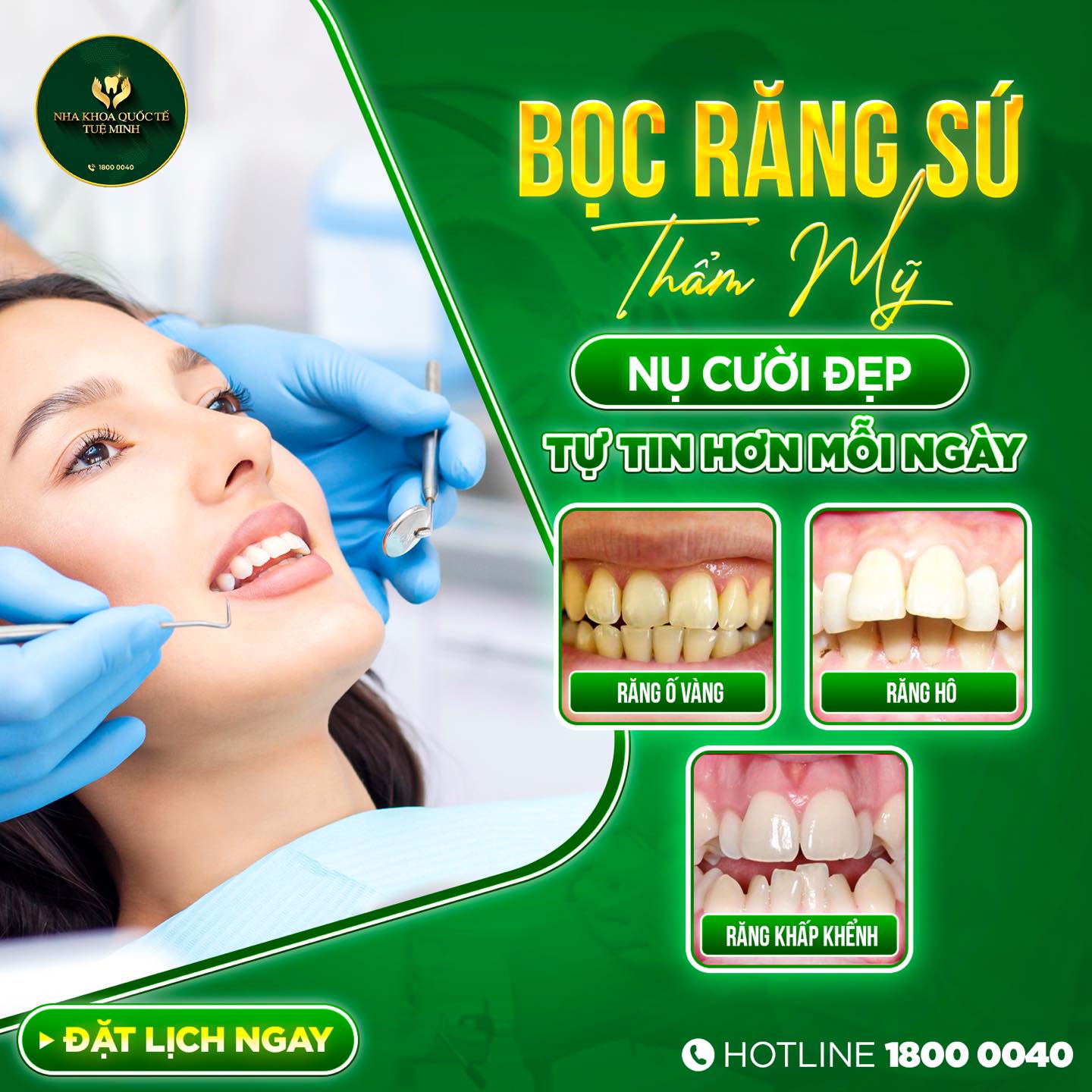 BỌC RĂNG SỨ THẨM MỸ – NỤ CƯỜI ĐẸP, TỰ TIN HƠN MỖI NGÀY!
