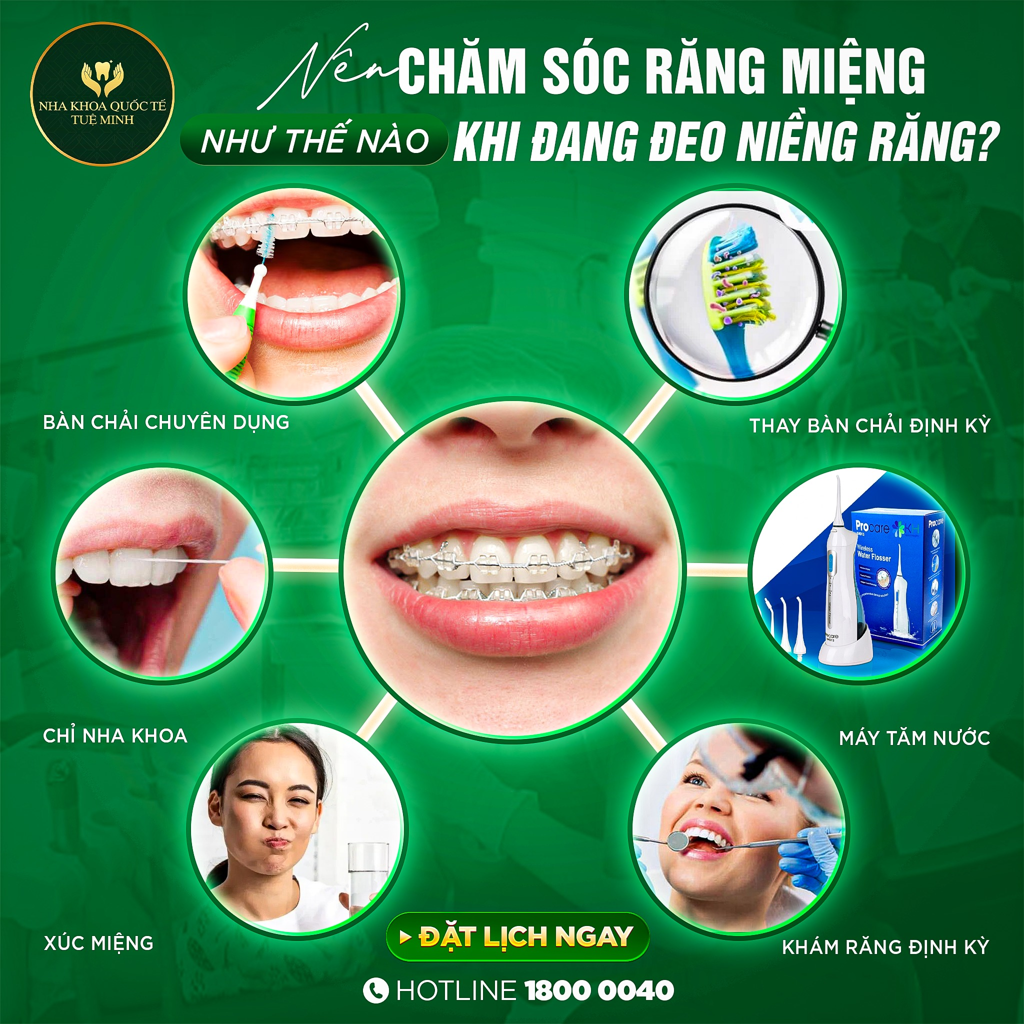 NÊN CHĂM SÓC RĂNG MIỆNG NHƯ THẾ NÀO KHI ĐANG ĐEO NIỀNG RĂNG?