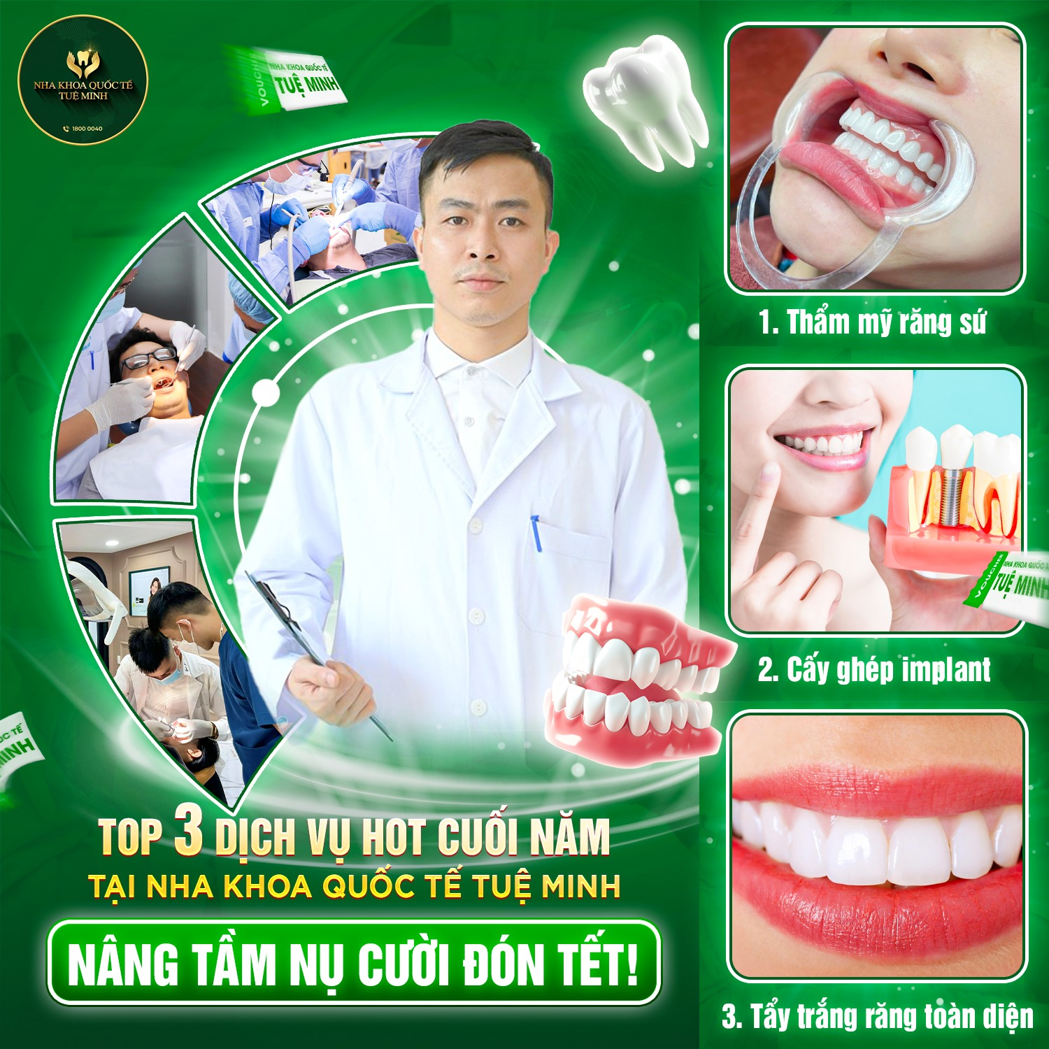 TOP 3 DỊCH VỤ HOT CUỐI NĂM TẠI NHA KHOA QUỐC TẾ TUỆ MINH – NÂNG TẦM NỤ CƯỜI ĐÓN TẾT!