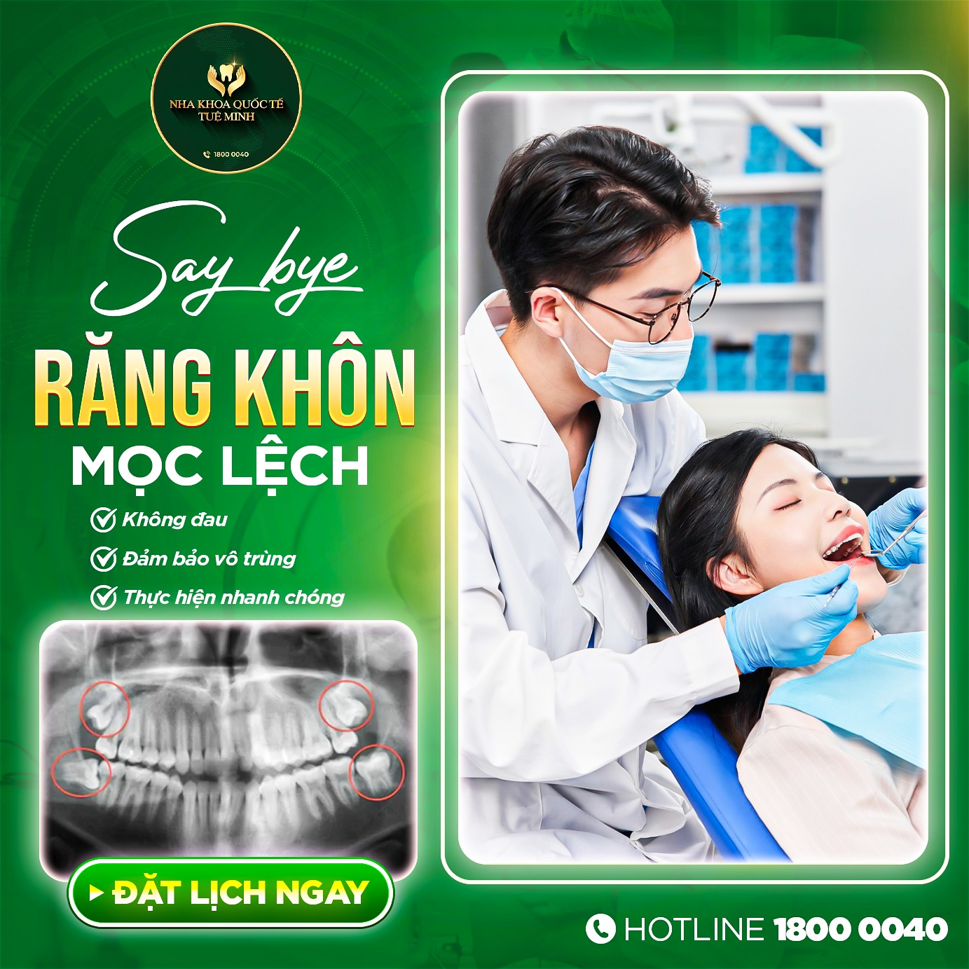 SAY BYE VỚI RĂNG KHÔN MỌC LỆCH!