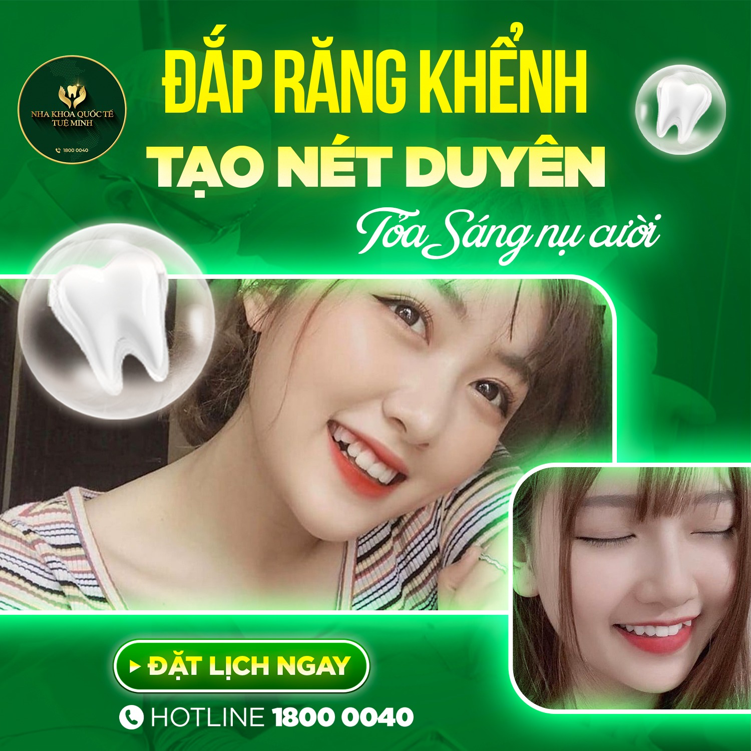 ĐẮP RĂNG KHỂNH TẠO NÉT DUYÊN – TỎA SÁNG NỤ CƯỜI