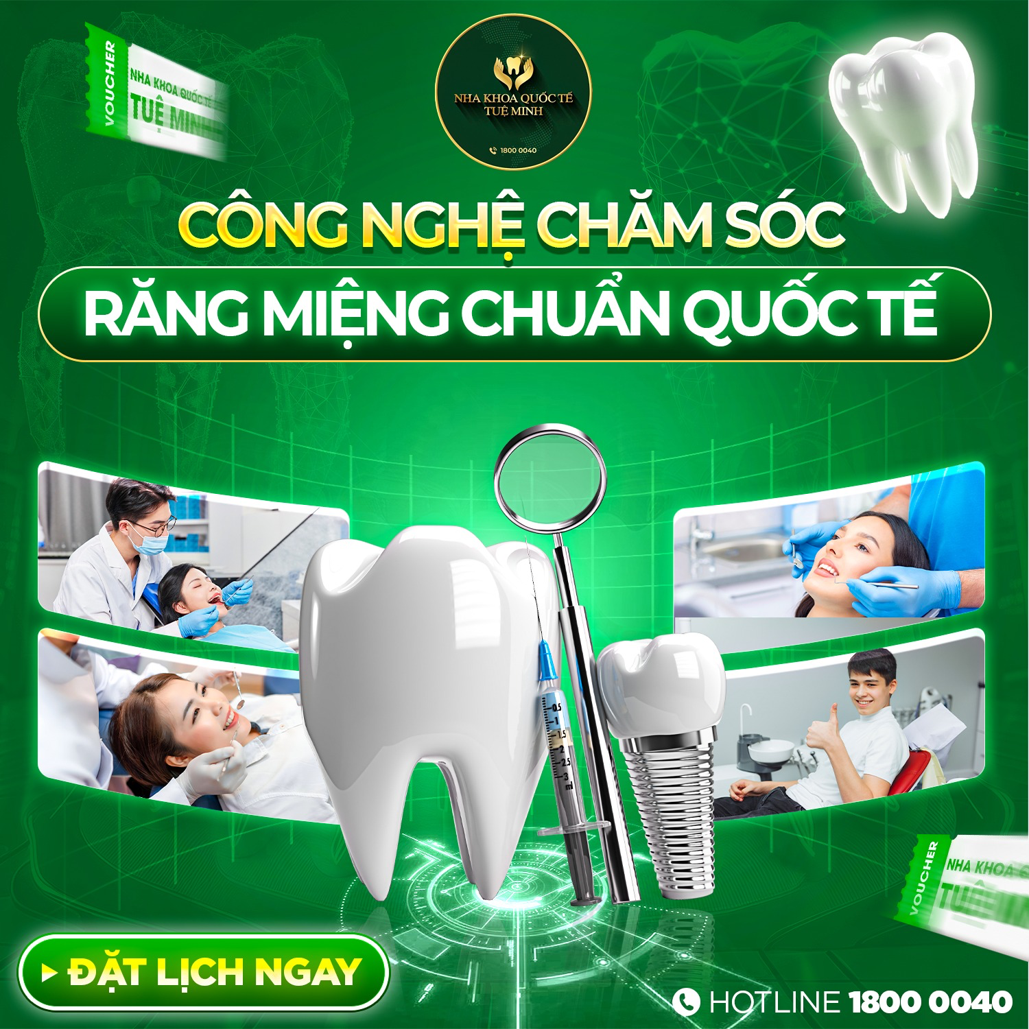 Công Nghệ Chăm Sóc Răng Miệng Chuẩn Quốc Tế Tại Nha Khoa Quốc Tế Tuệ Minh