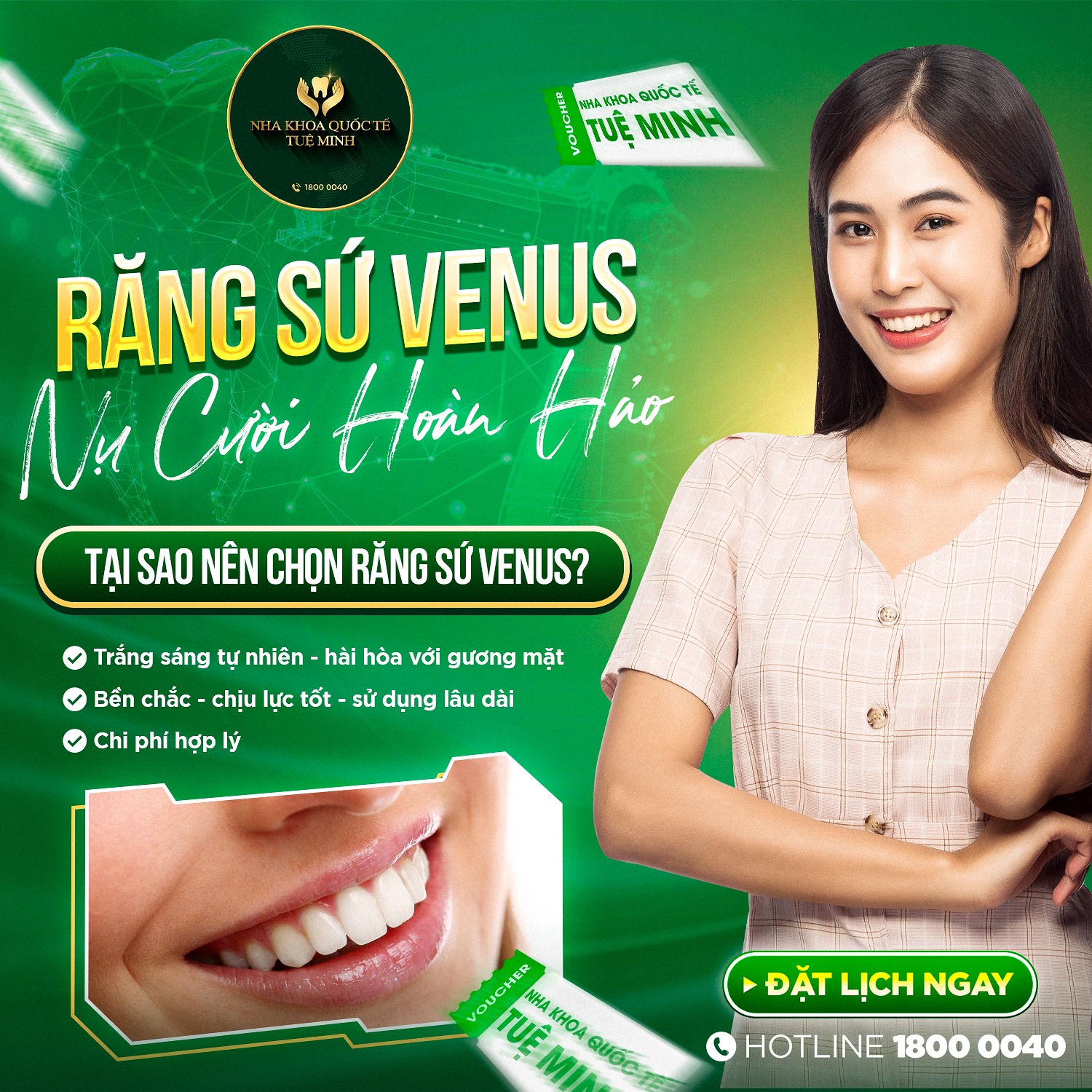 RĂNG SỨ VENUS – NỤ CƯỜI HOÀN HẢO!