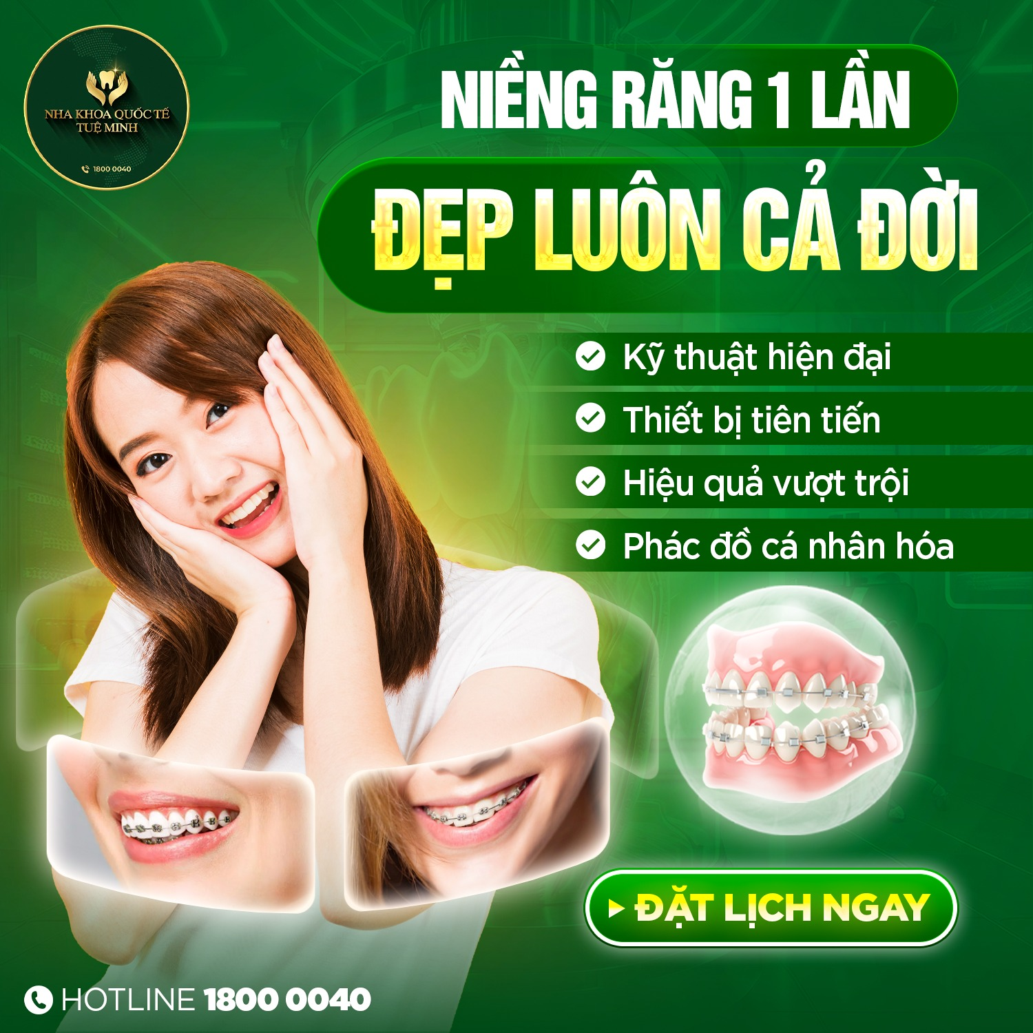 NIỀNG RĂNG 1 LẦN – ĐẸP LUÔN CẢ ĐỜI!
