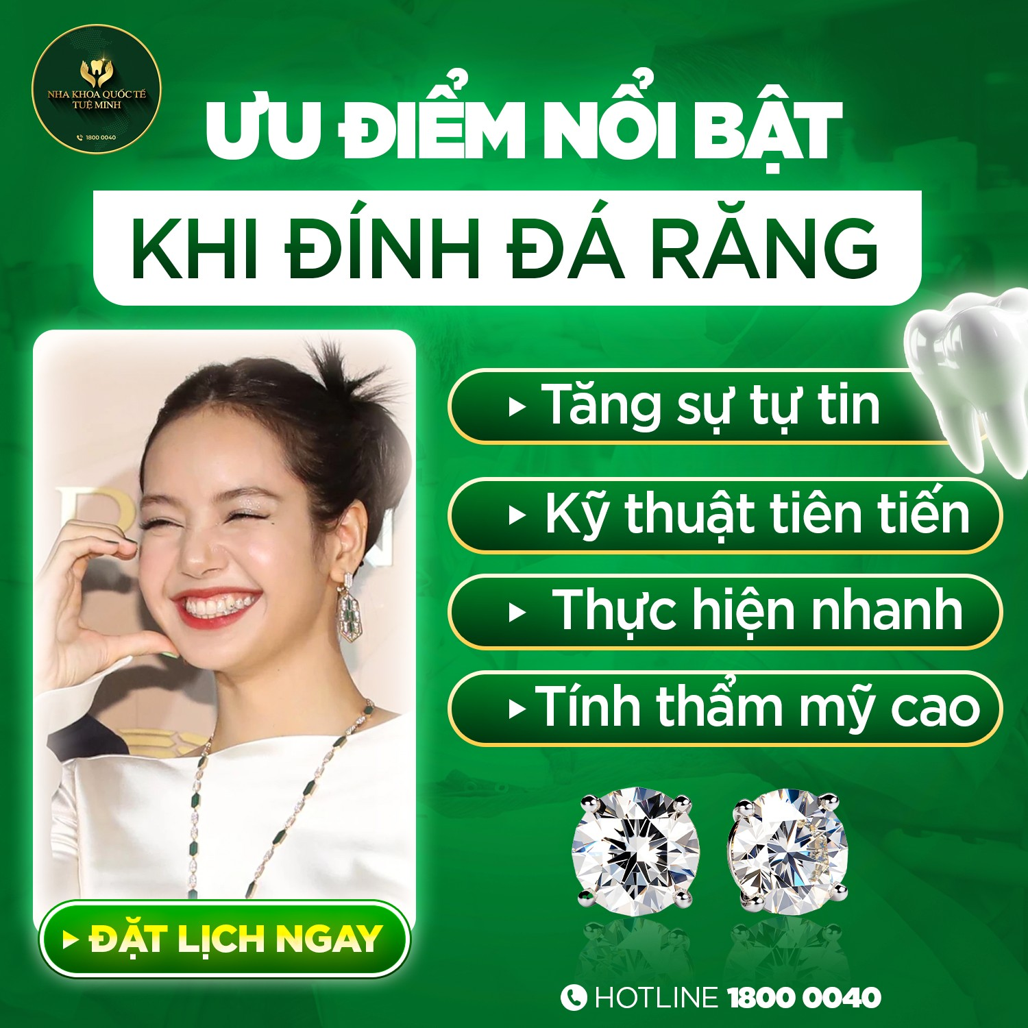ƯU ĐIỂM NỔI BẬT KHI ĐÍNH ĐÁ RĂNG TẠI NHA KHOA QUỐC TẾ TUỆ MINH