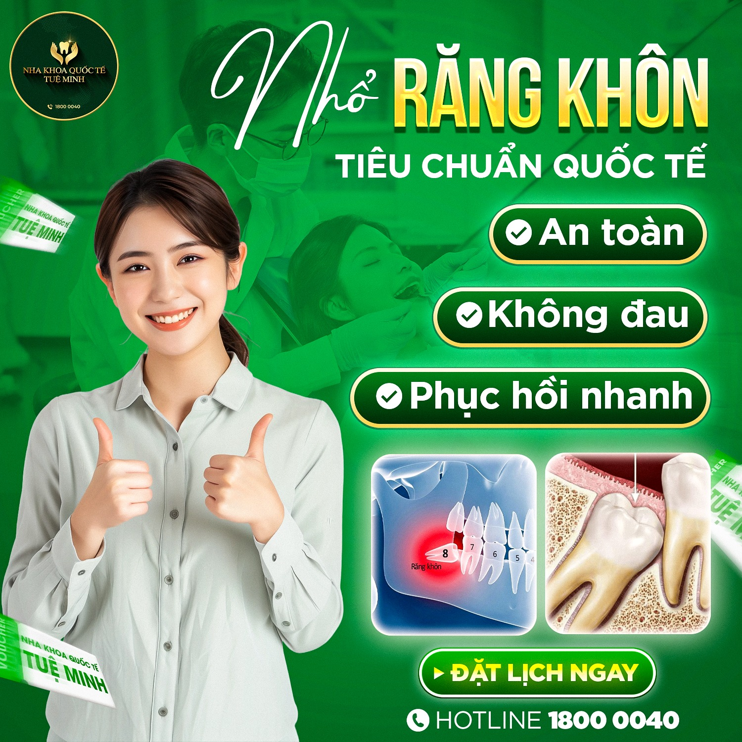 NHỔ RĂNG KHÔN TIÊU CHUẨN QUỐC TẾ!