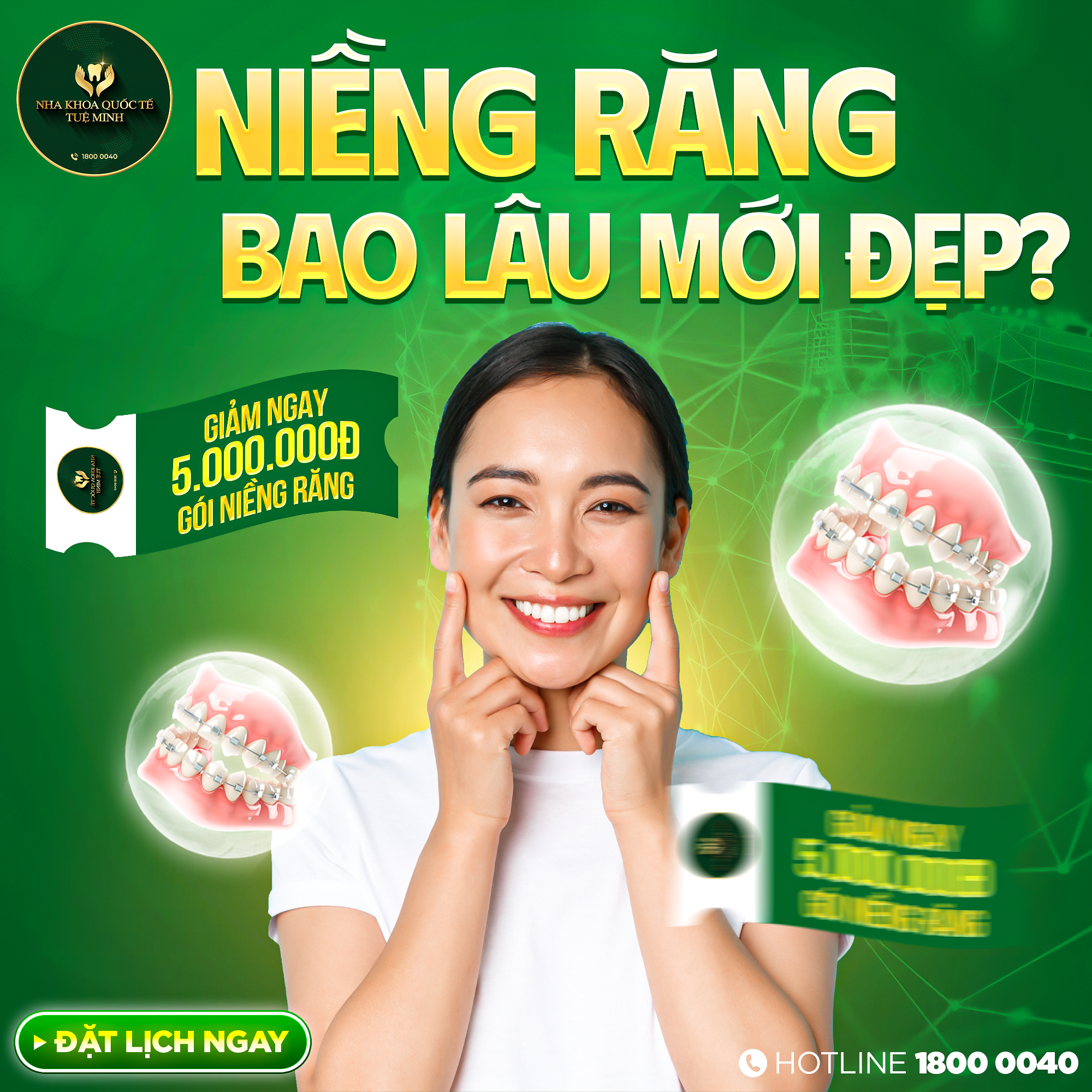 NIỀNG RĂNG BAO LÂU MỚI ĐẸP? 