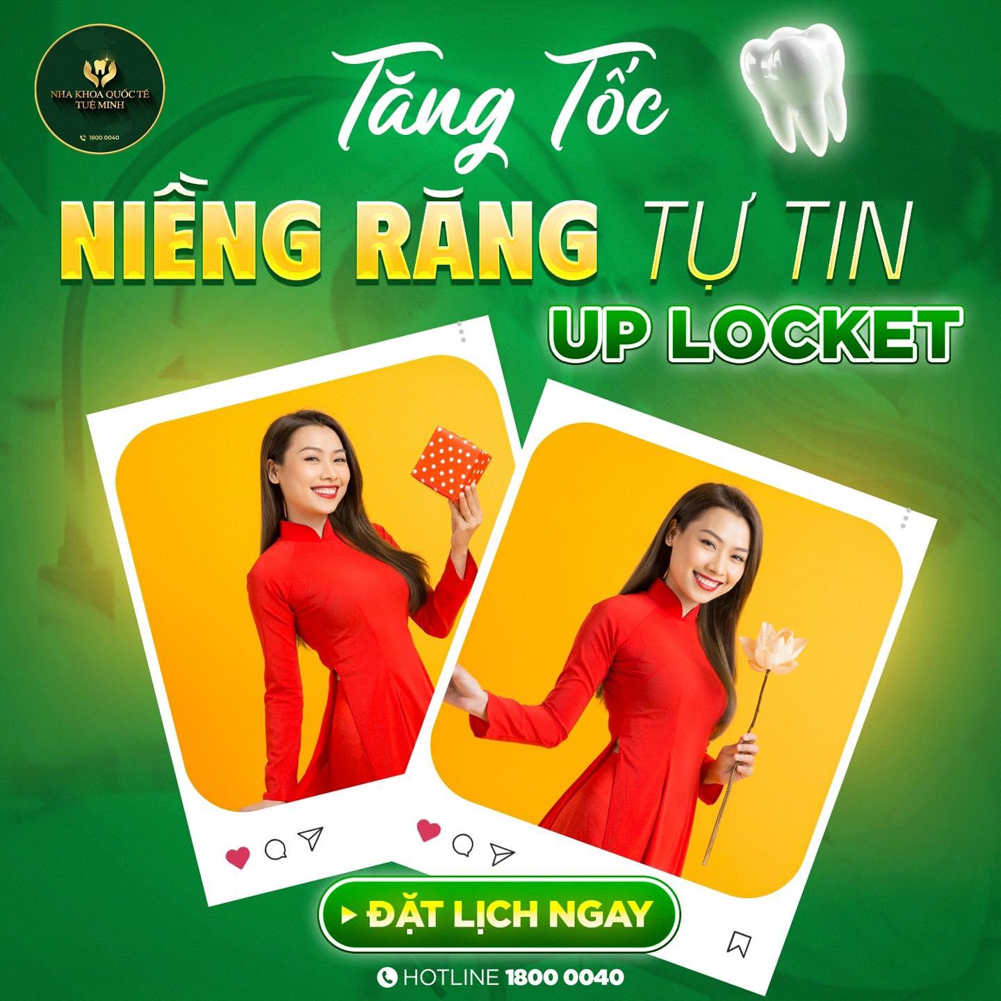 Tăng Tốc Niềng Răng – Tự Tin Up Locket