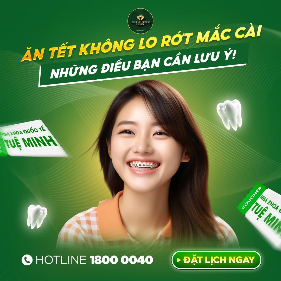Không Lo Rớt Mắc Cài – Những Điều Bạn Cần Lưu Ý!
