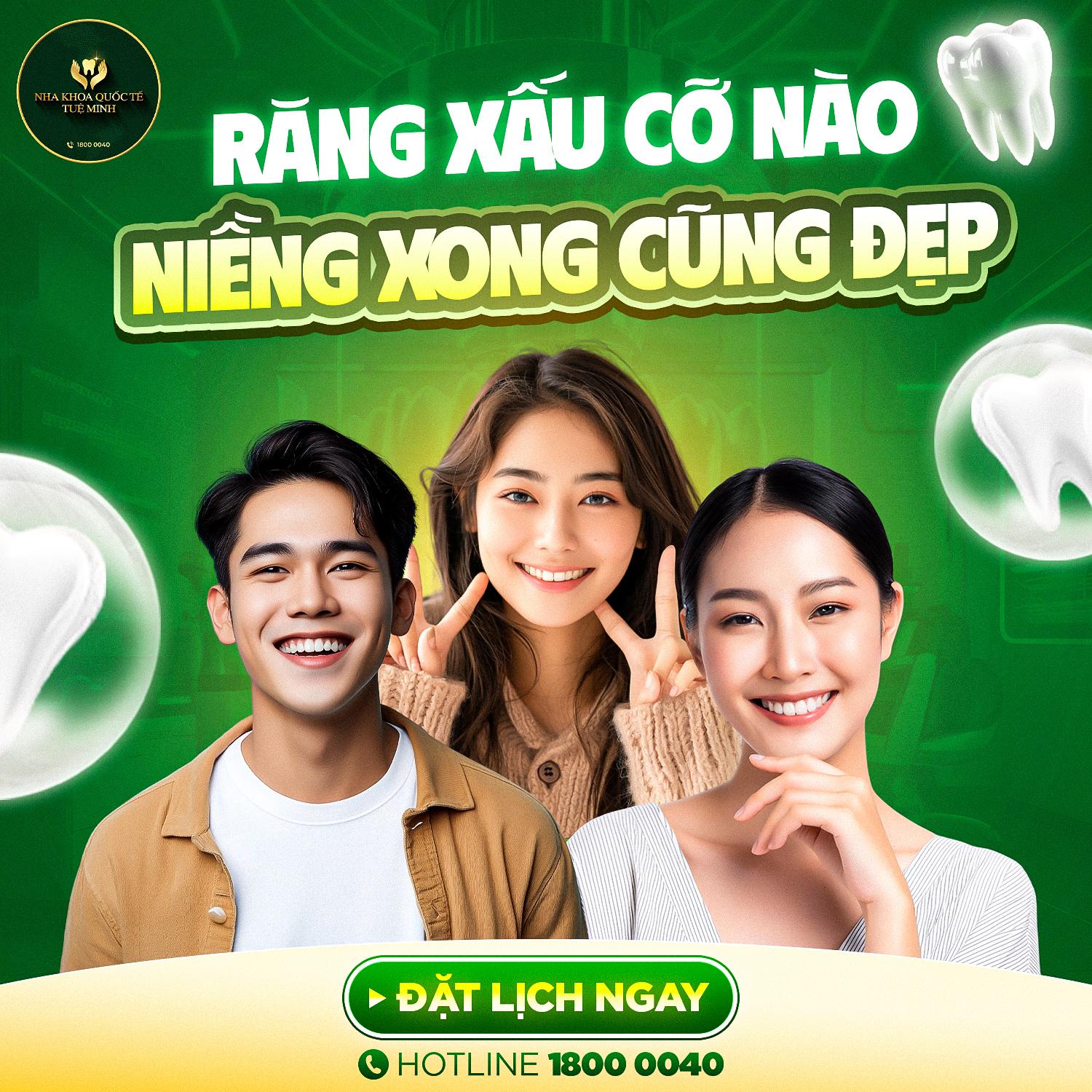 Răng Xấu Cỡ Nào Niềng Răng Xong Cũng Đẹp