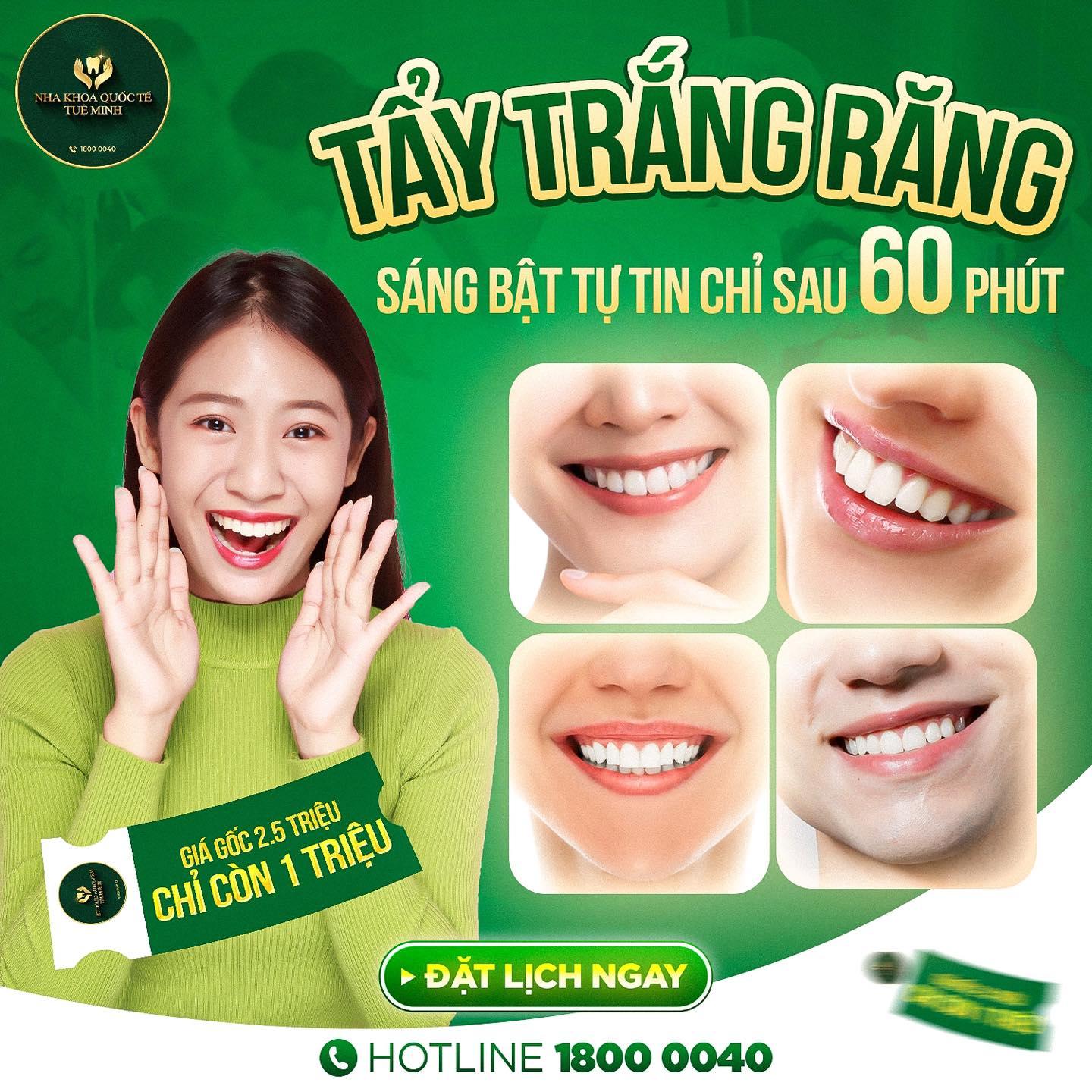 TẨY TRẮNG RĂNG – SÁNG BẬT TỰ TIN CHỈ SAU 60 PHÚT!