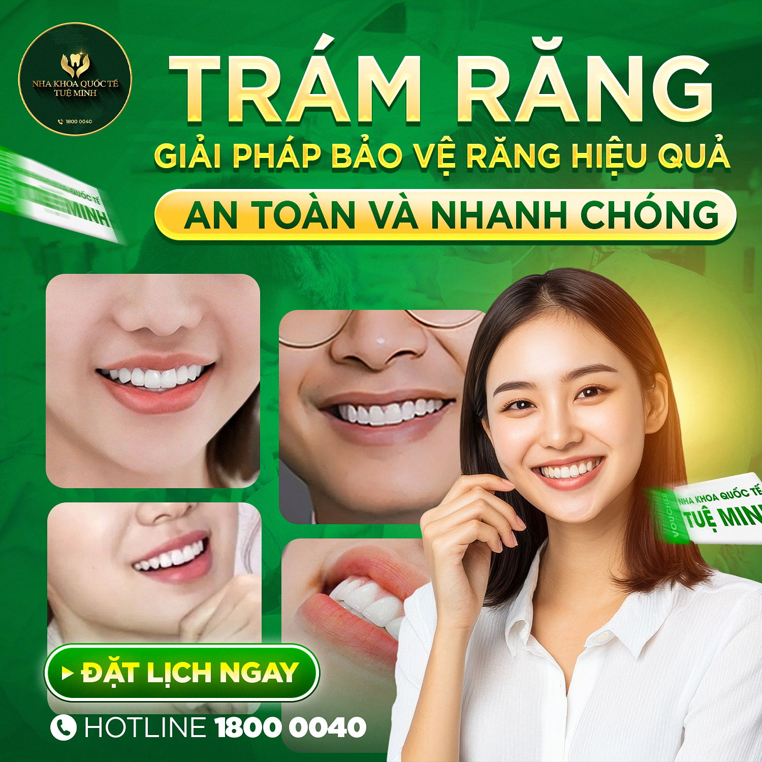 TRÁM RĂNG – GIẢI PHÁP BẢO VỆ RĂNG HIỆU QUẢ