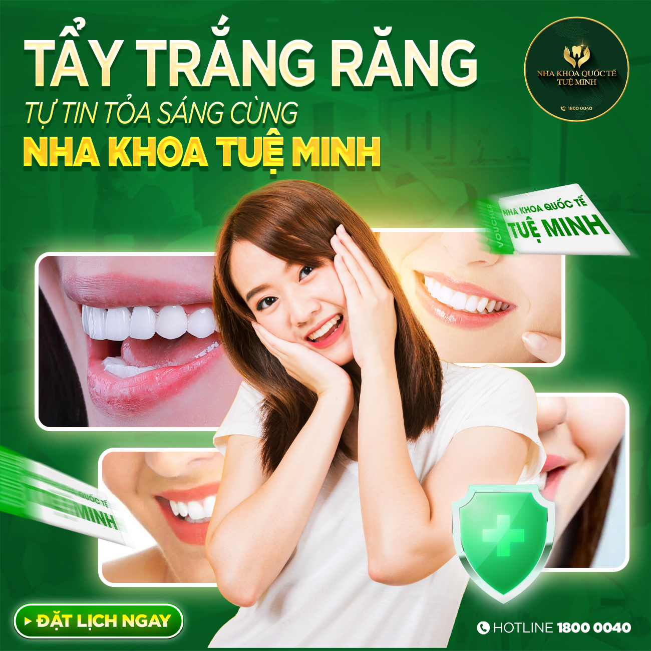 TẨY TRẮNG RĂNG – TỰ TIN TỎA SÁNG