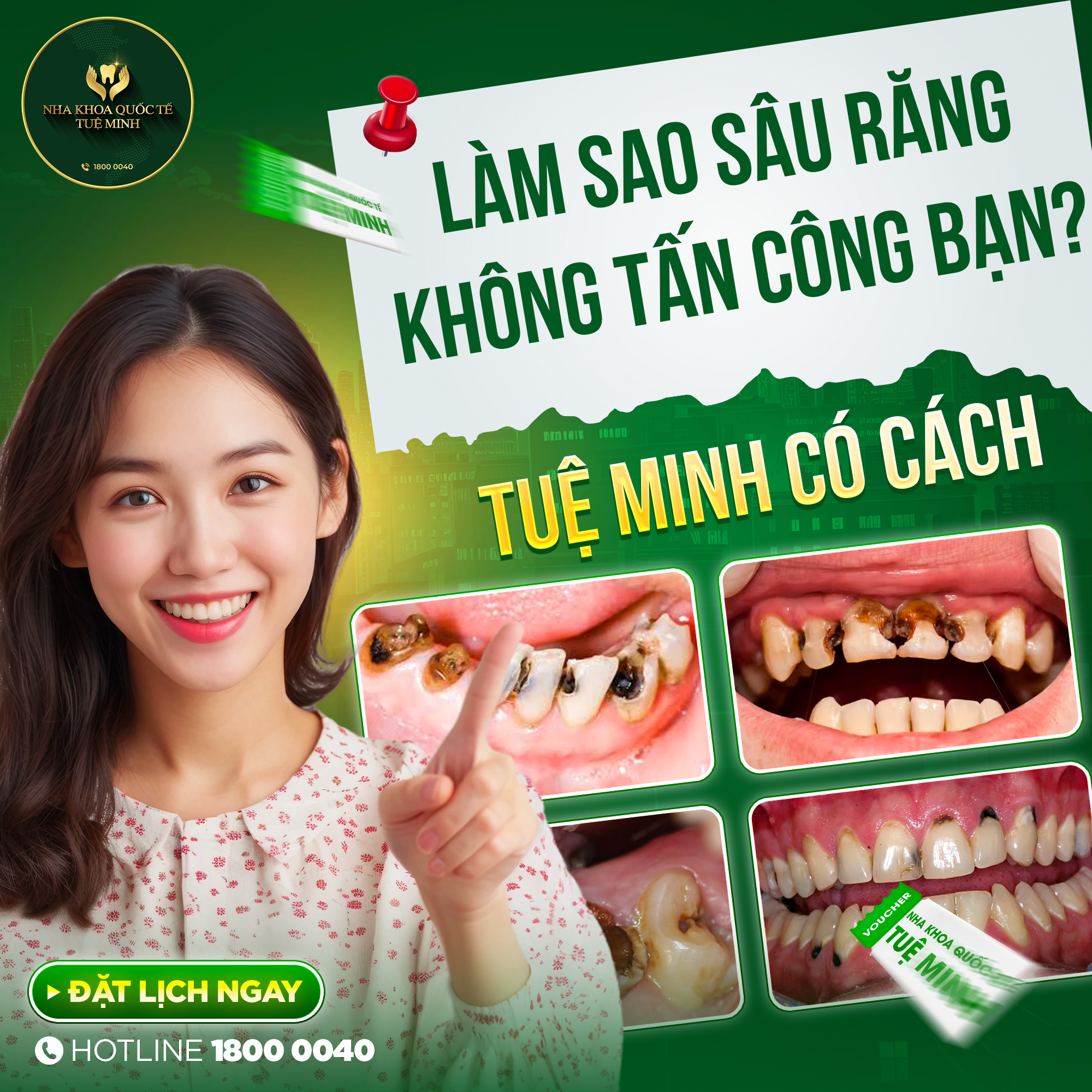 LÀM SAO SÂU RĂNG KHÔNG TẤN CÔNG BẠN? 