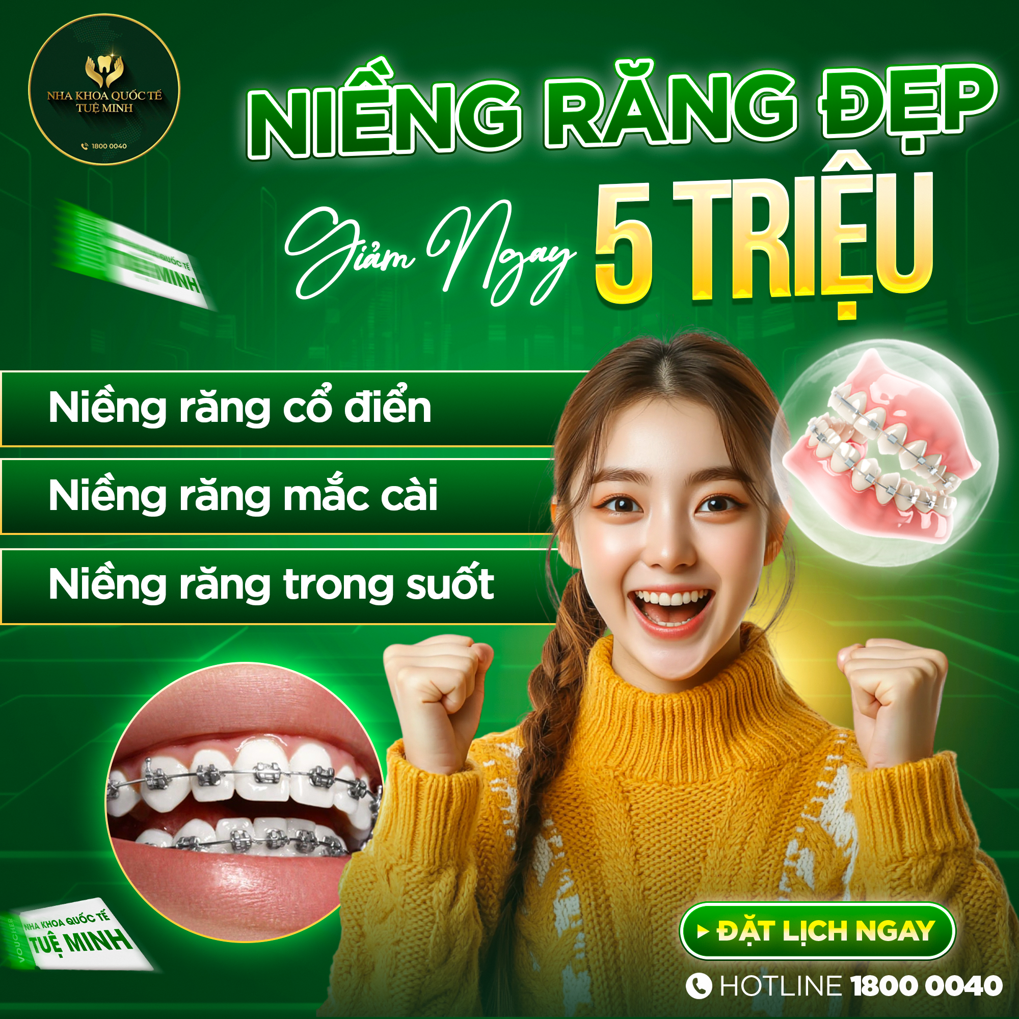 Niềng Răng Đẹp – Giảm 5 Triệu Ngay!