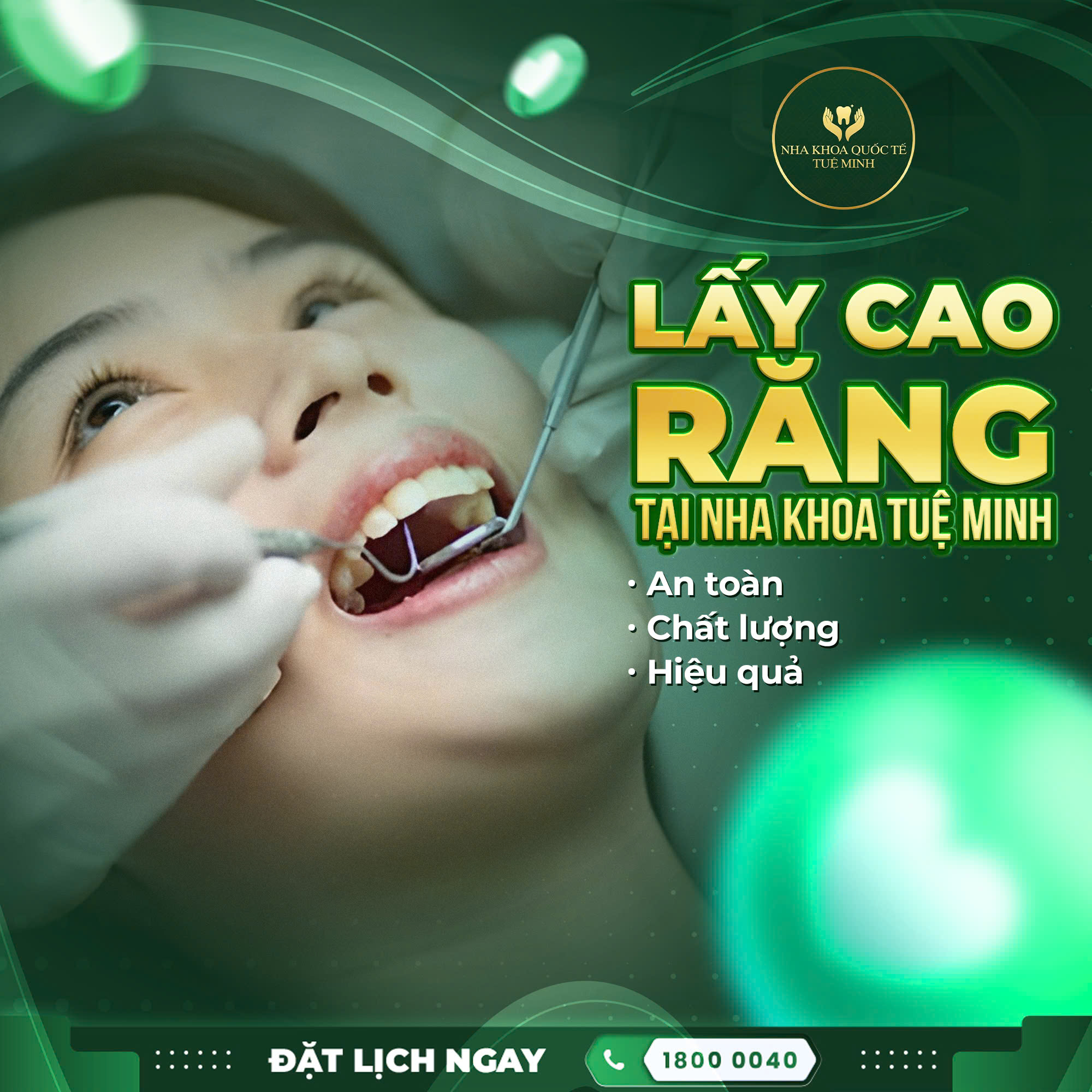 Lấy Cao Răng Tại Nha Khoa Tuệ Minh