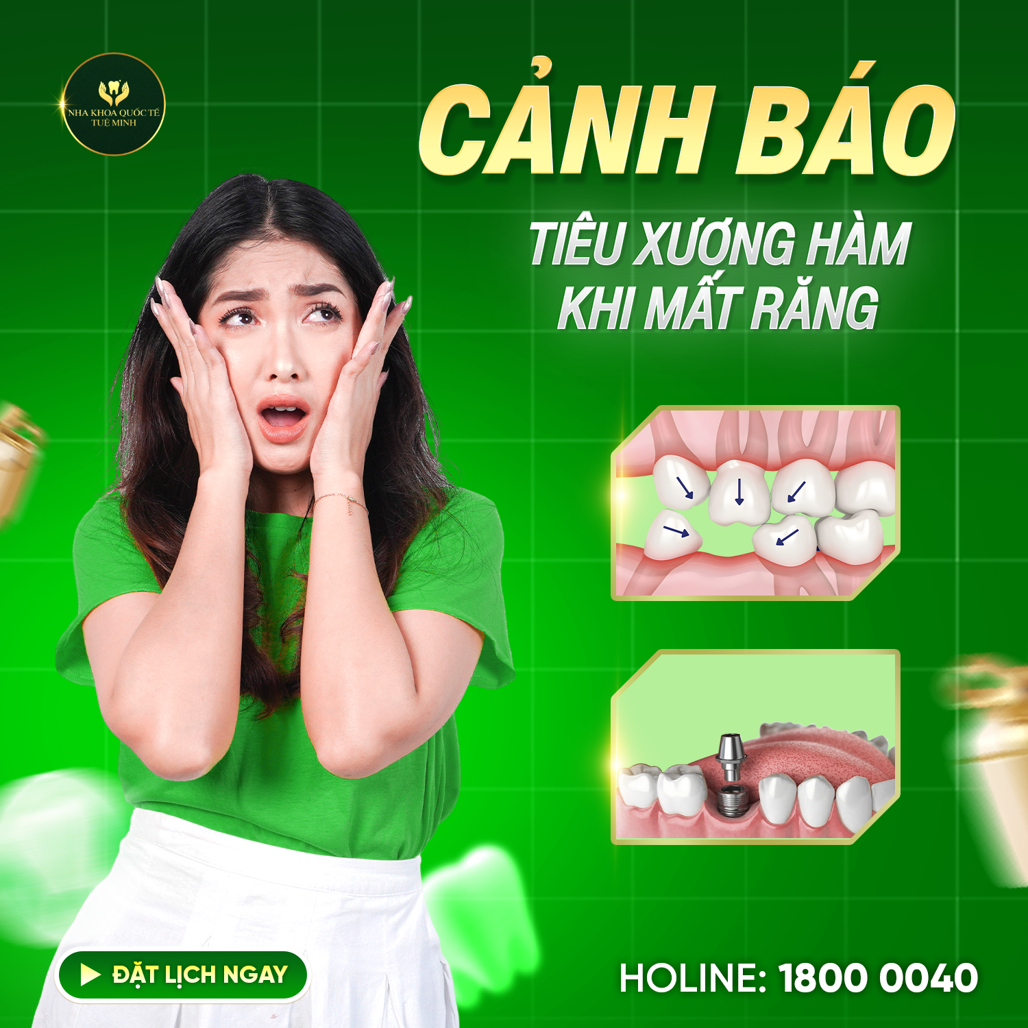  CẢNH BÁO TIÊU XƯƠNG HÀM KHI MẤT RĂNG! 