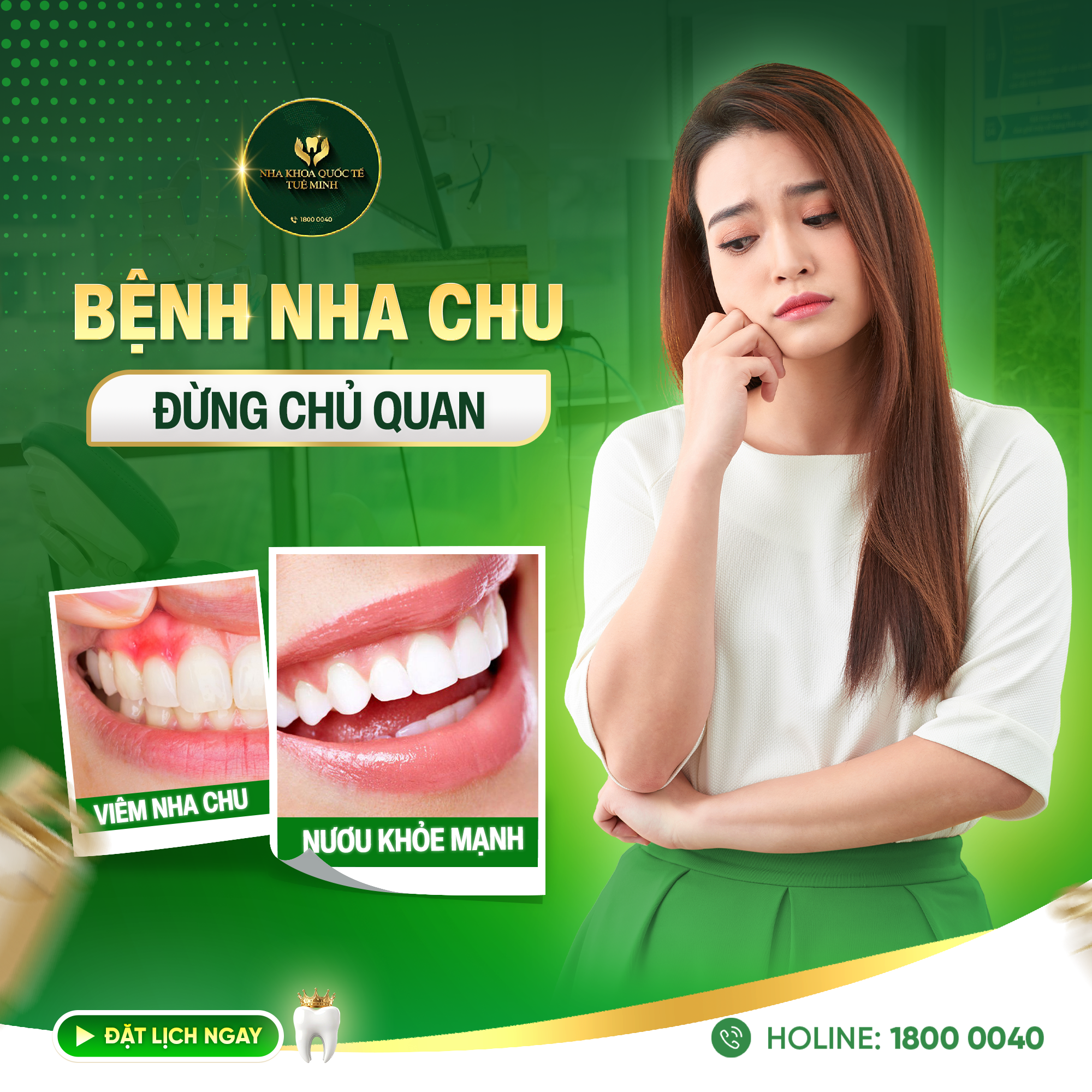 Bệnh Nha Chu – Đừng Chủ Quan Với Lợi Viêm Chảy Máu!