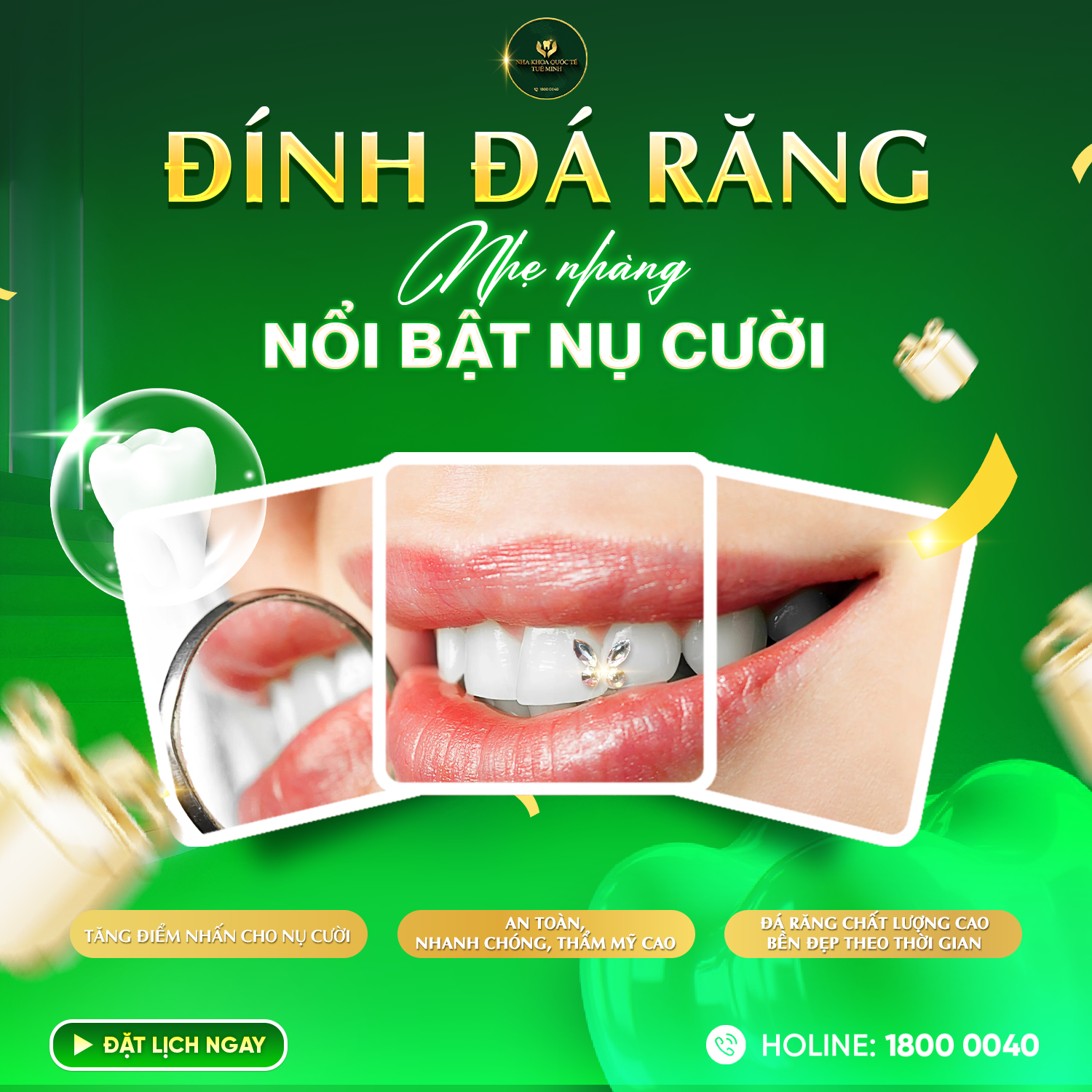 ĐÍNH ĐÁ RĂNG – NHẸ NHÀNG NỔI BẬT NỤ CƯỜI 