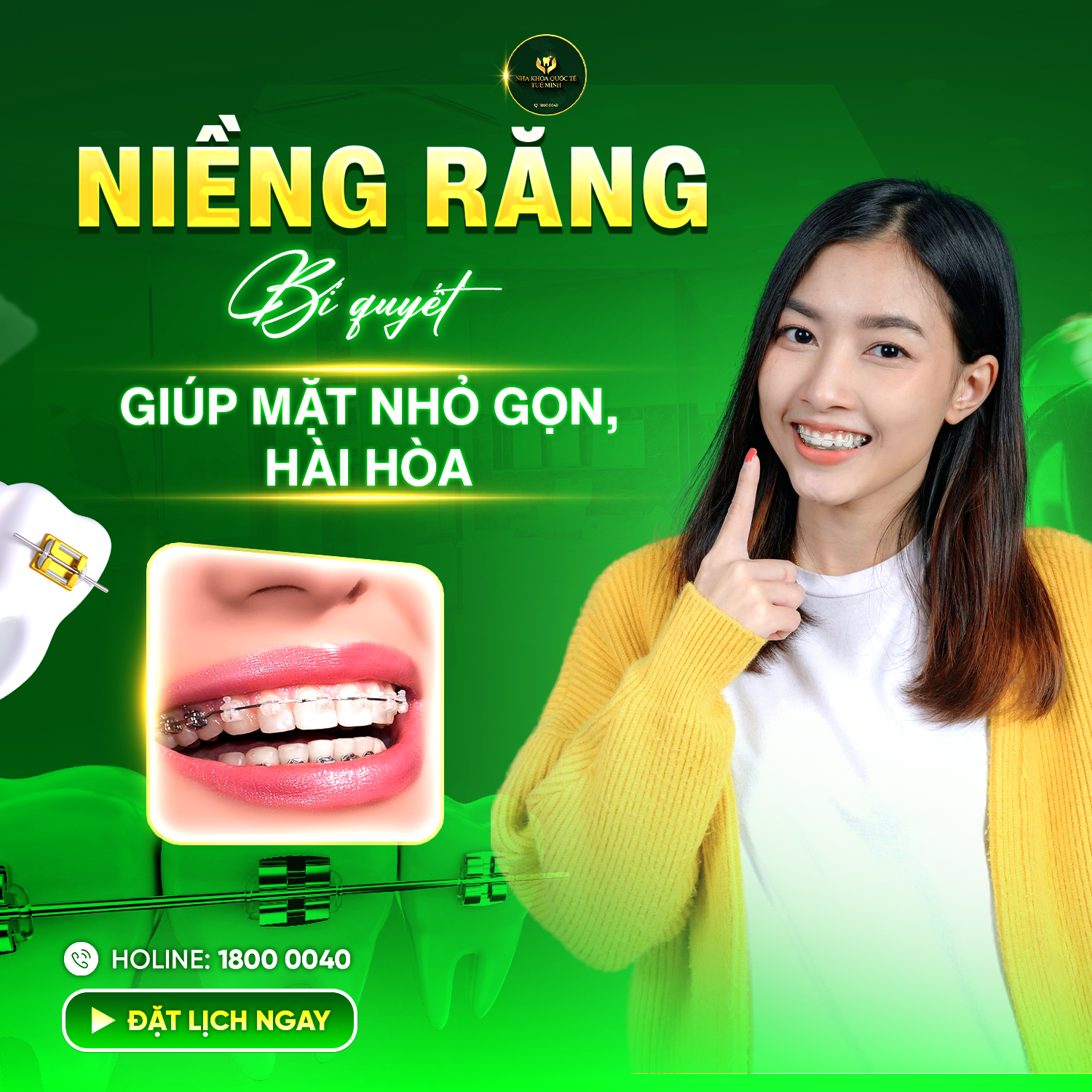 Niềng Răng – Bí Quyết Giúp Mặt Nhỏ Gọn, Hài Hòa Hơn 