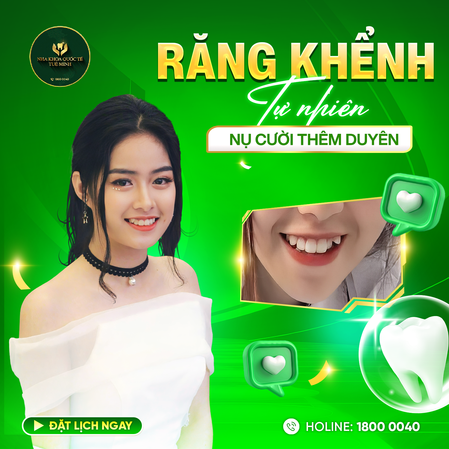Răng Khểnh Tự Nhiên – Nụ Cười Thêm Duyên 