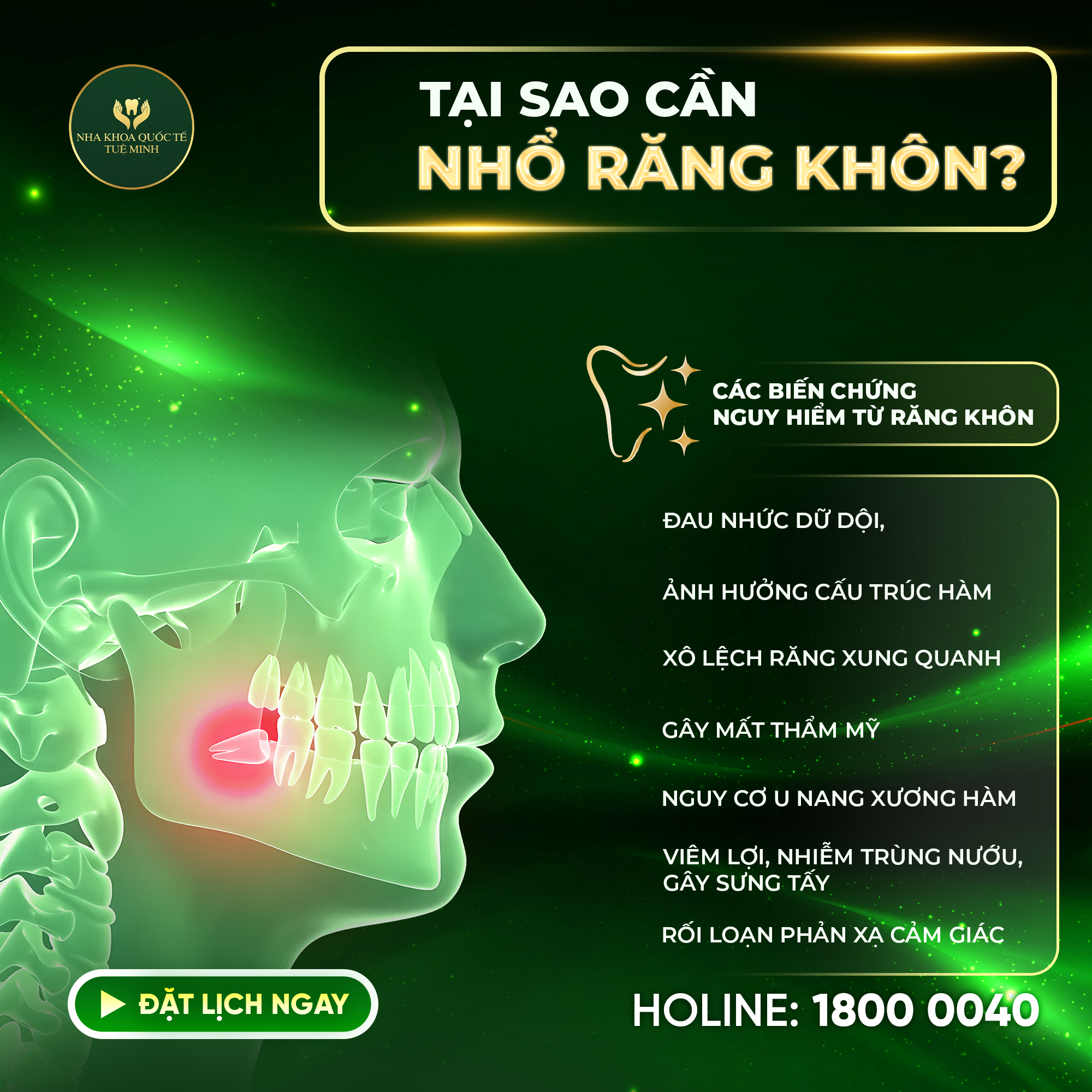 Tại Sao Cần Nhổ Răng Khôn? 