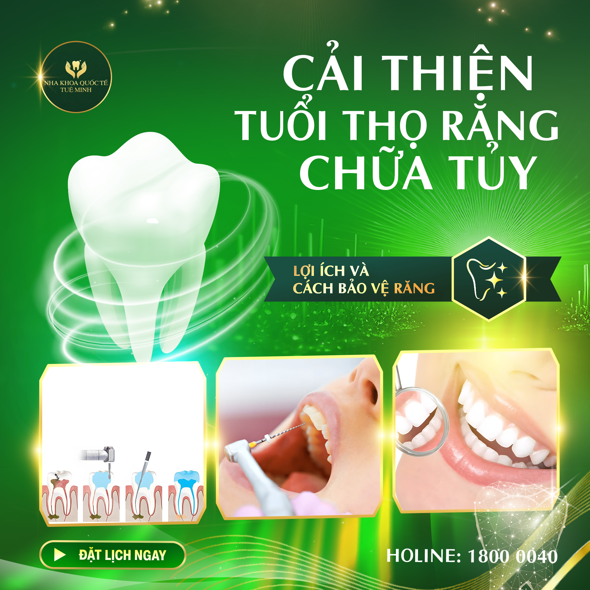 Cải Thiện Tuổi Thọ Răng Chữa Tủy