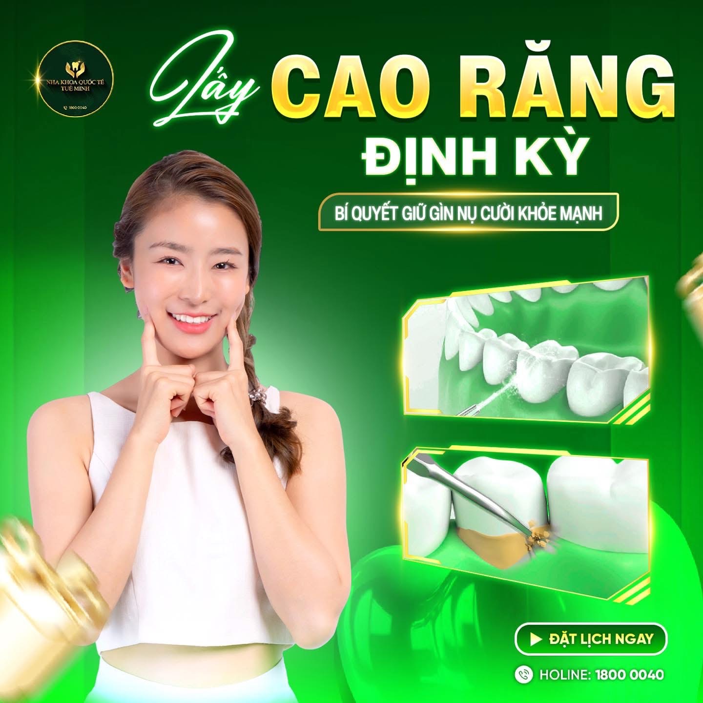 LẤY CAO RĂNG ĐỊNH KỲ – BÍ QUYẾT GIỮ NỤ CƯỜI